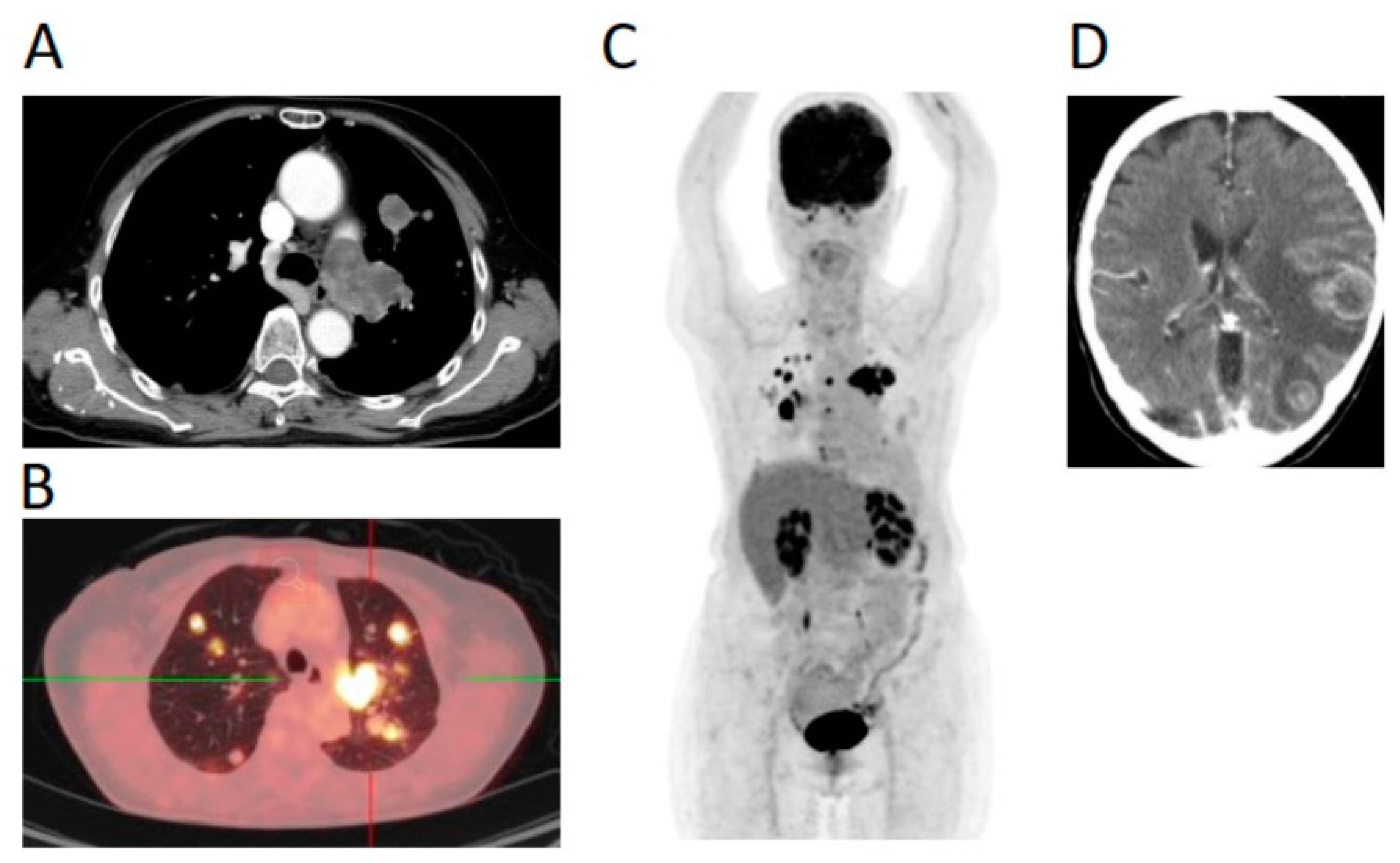 Jpm 11 00357 g002 Jpm 11 00357 g002