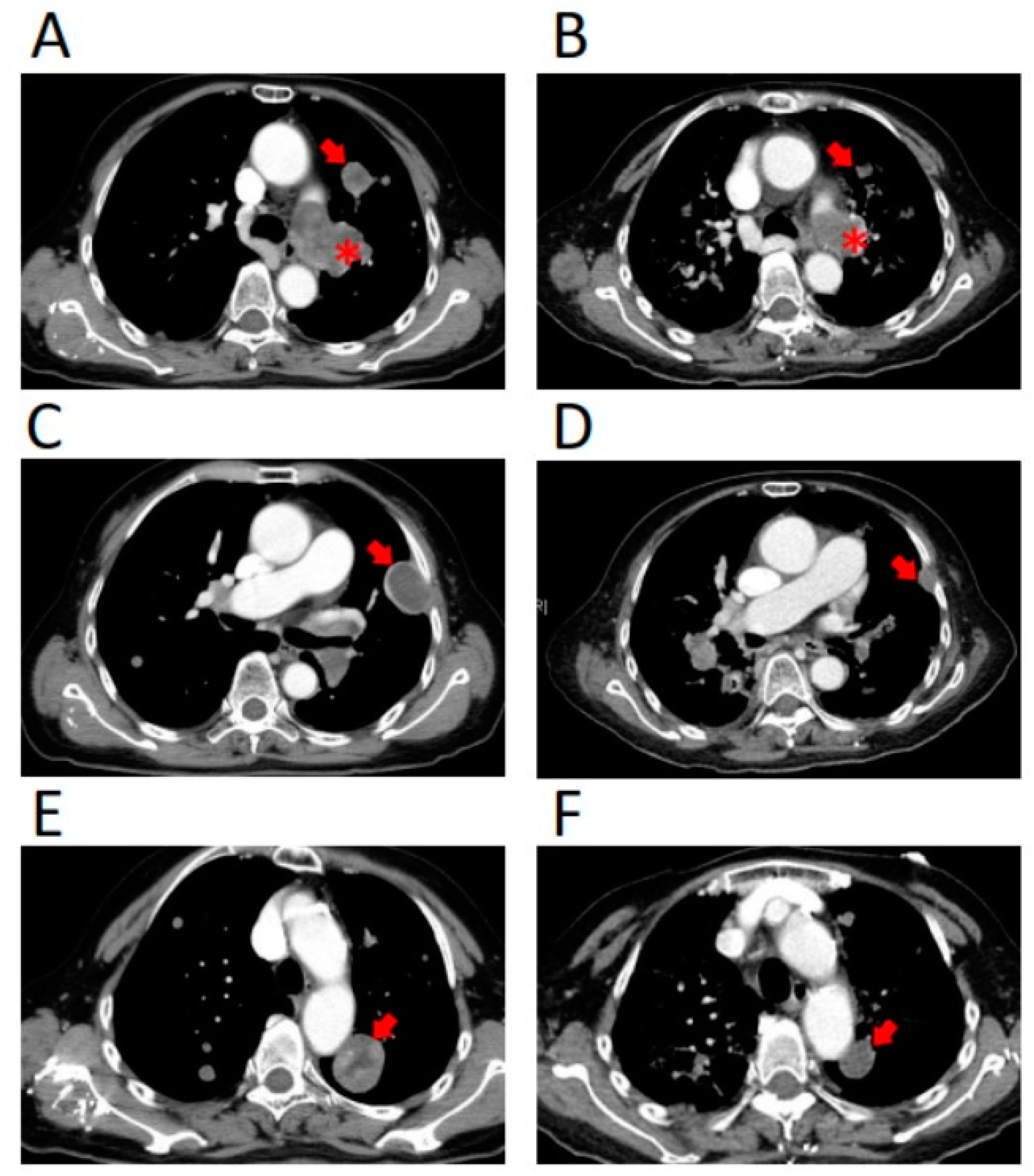Jpm 11 00357 g004 Jpm 11 00357 g004