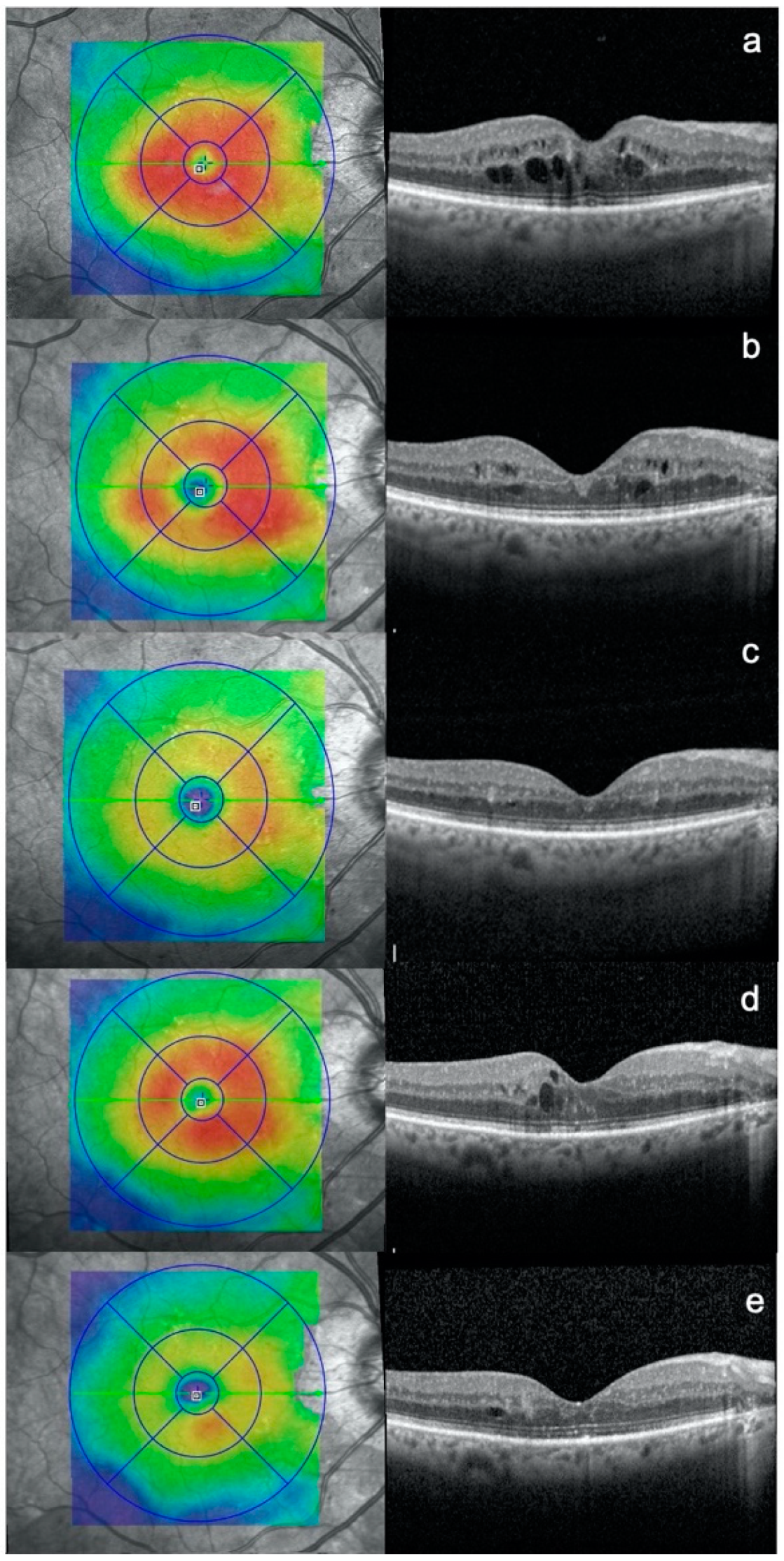 Jpm 11 00405 g001 Jpm 11 00405 g001