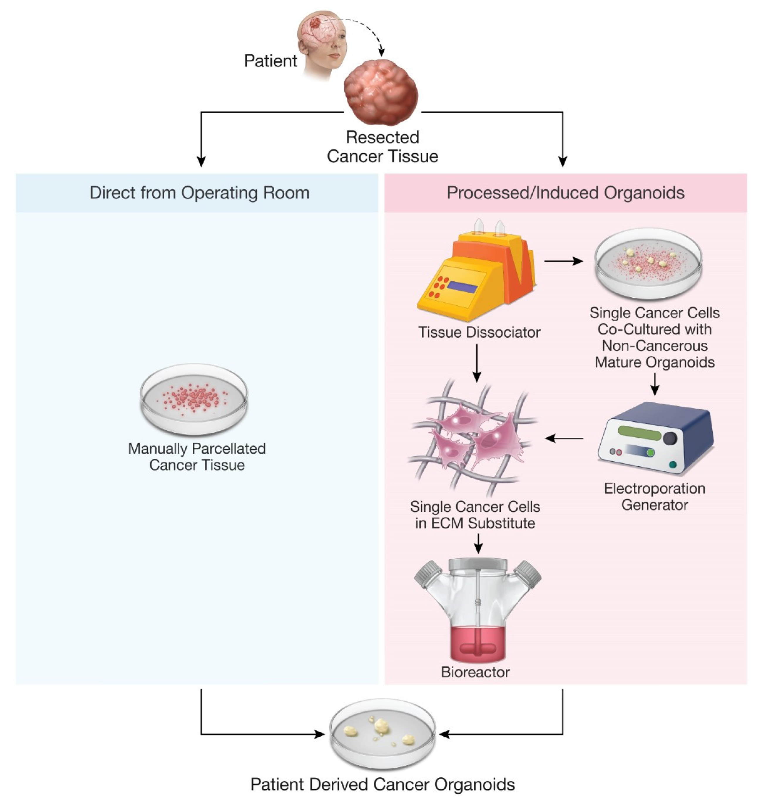 JPM Free Full-Text Patient-Derived Cancer Organoids for Precision Oncology Treatment