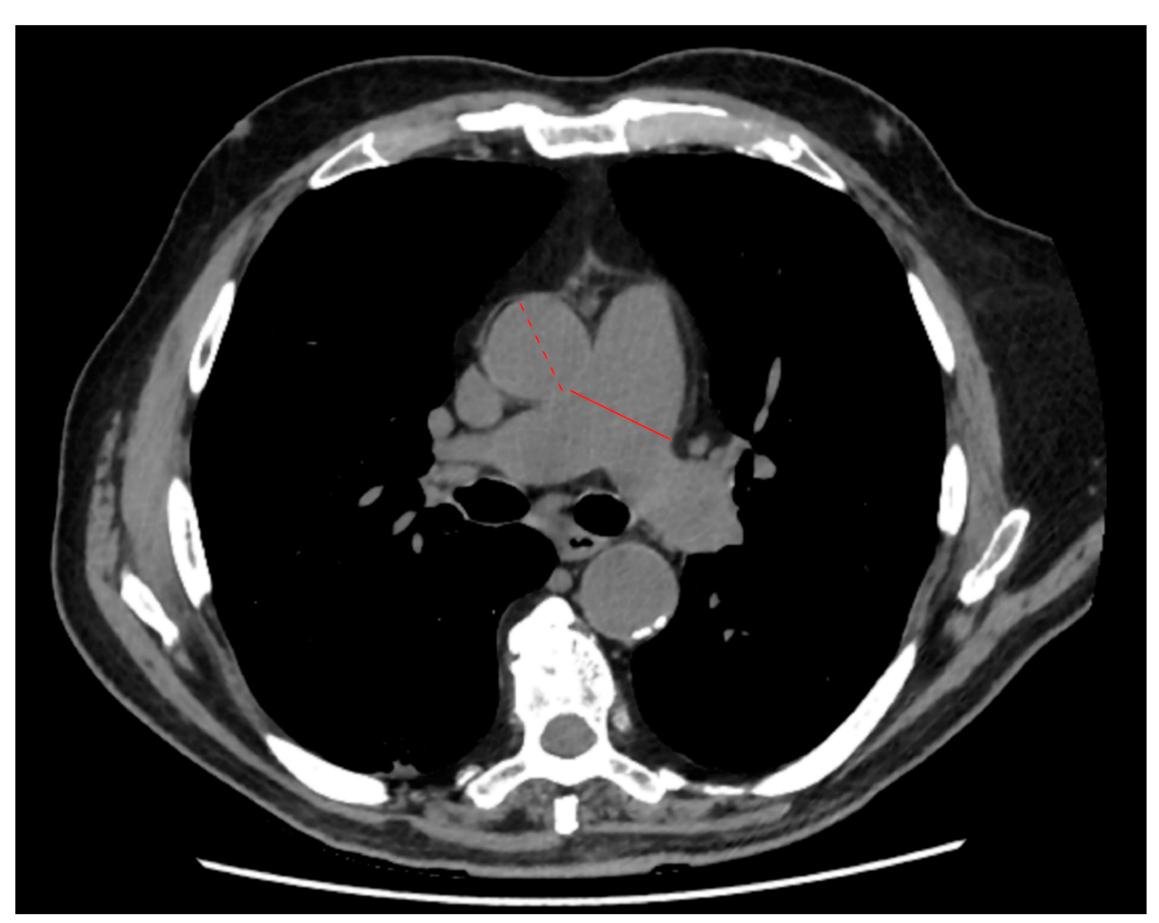 Jpm 11 00501 g001 Jpm 11 00501 g001