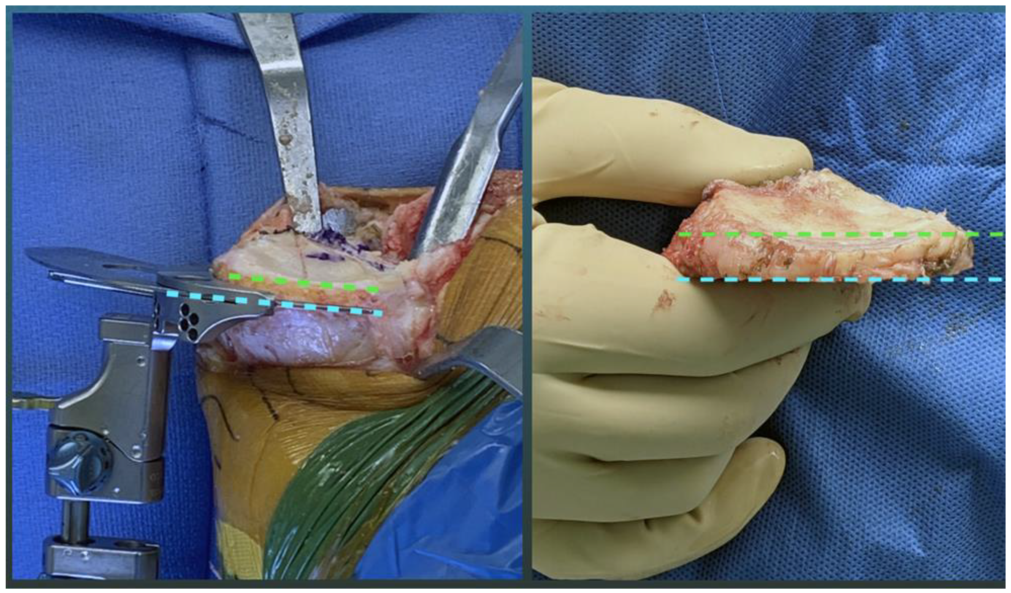 Jpm 11 00516 g001 Jpm 11 00516 g001