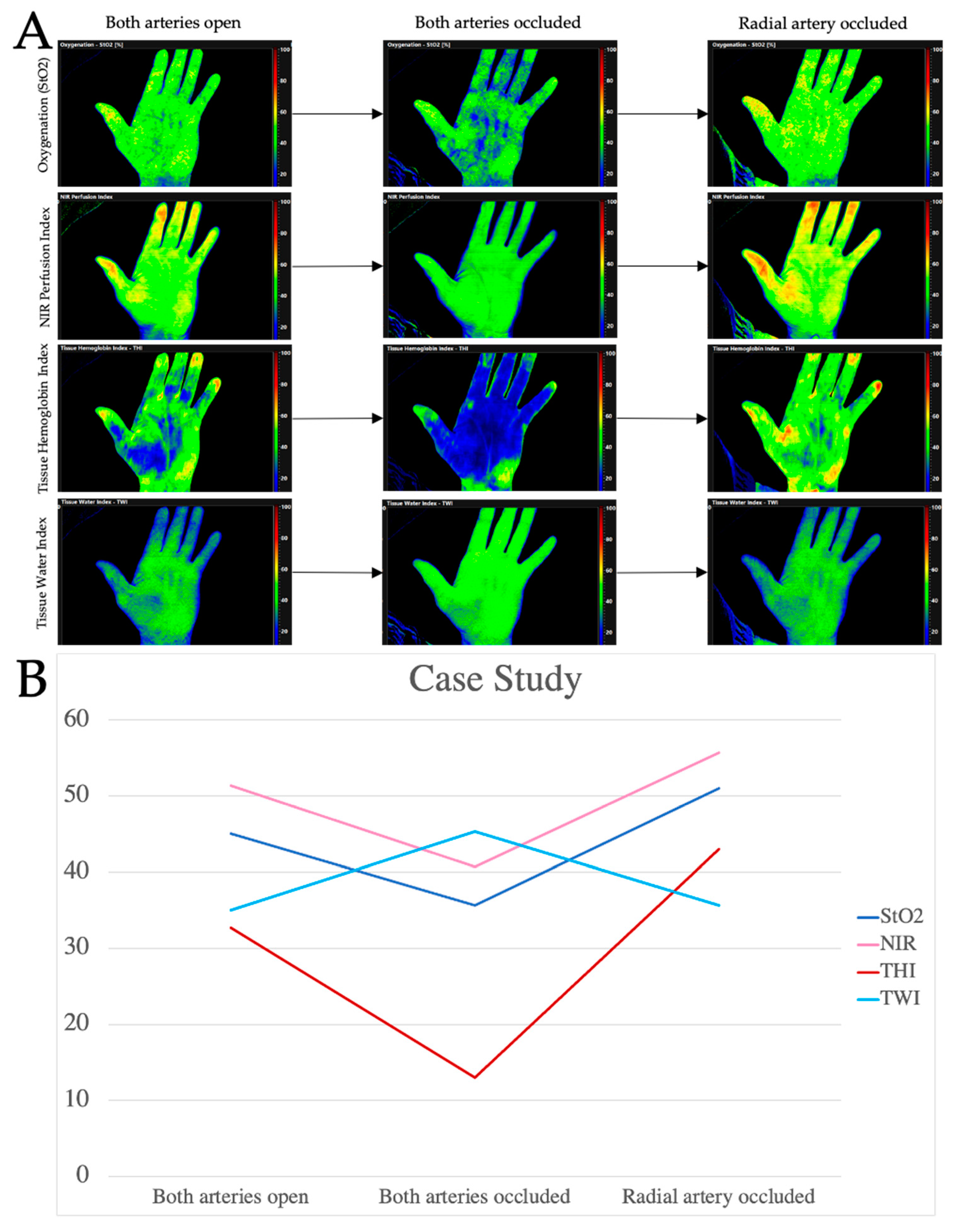 Jpm 11 00531 g007 Jpm 11 00531 g007