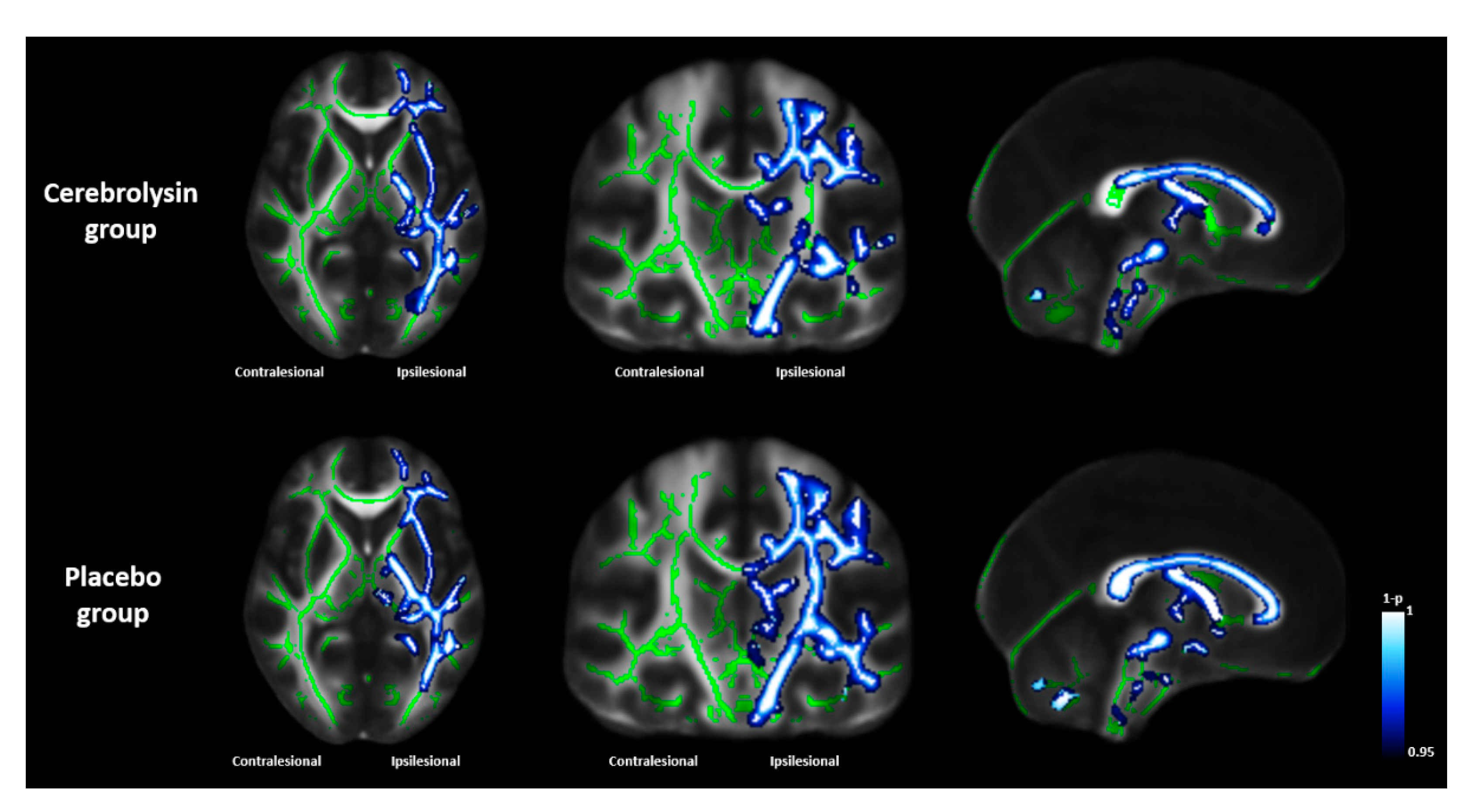 Jpm 11 00545 g004 Jpm 11 00545 g004