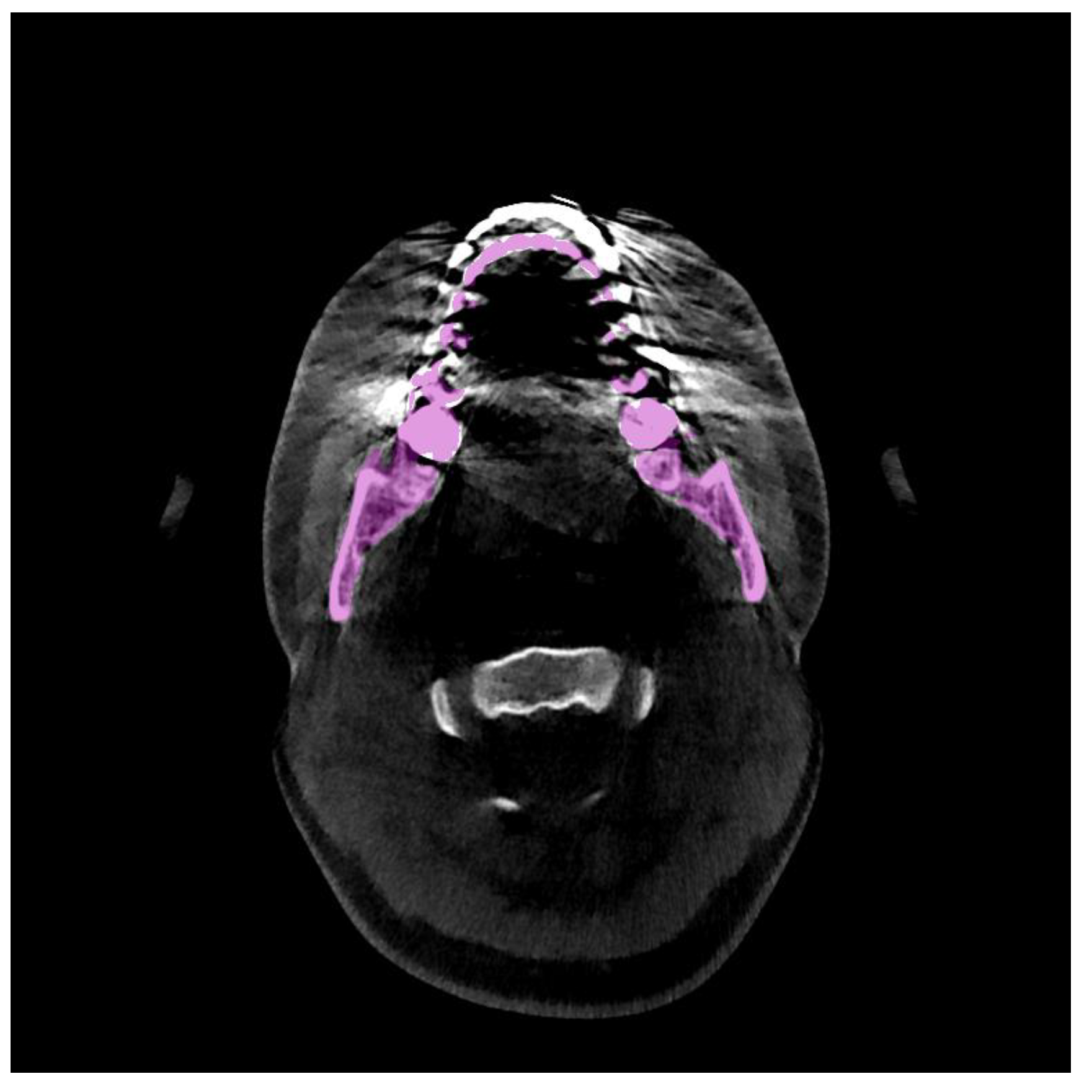 Jpm 11 00560 g001 Jpm 11 00560 g001