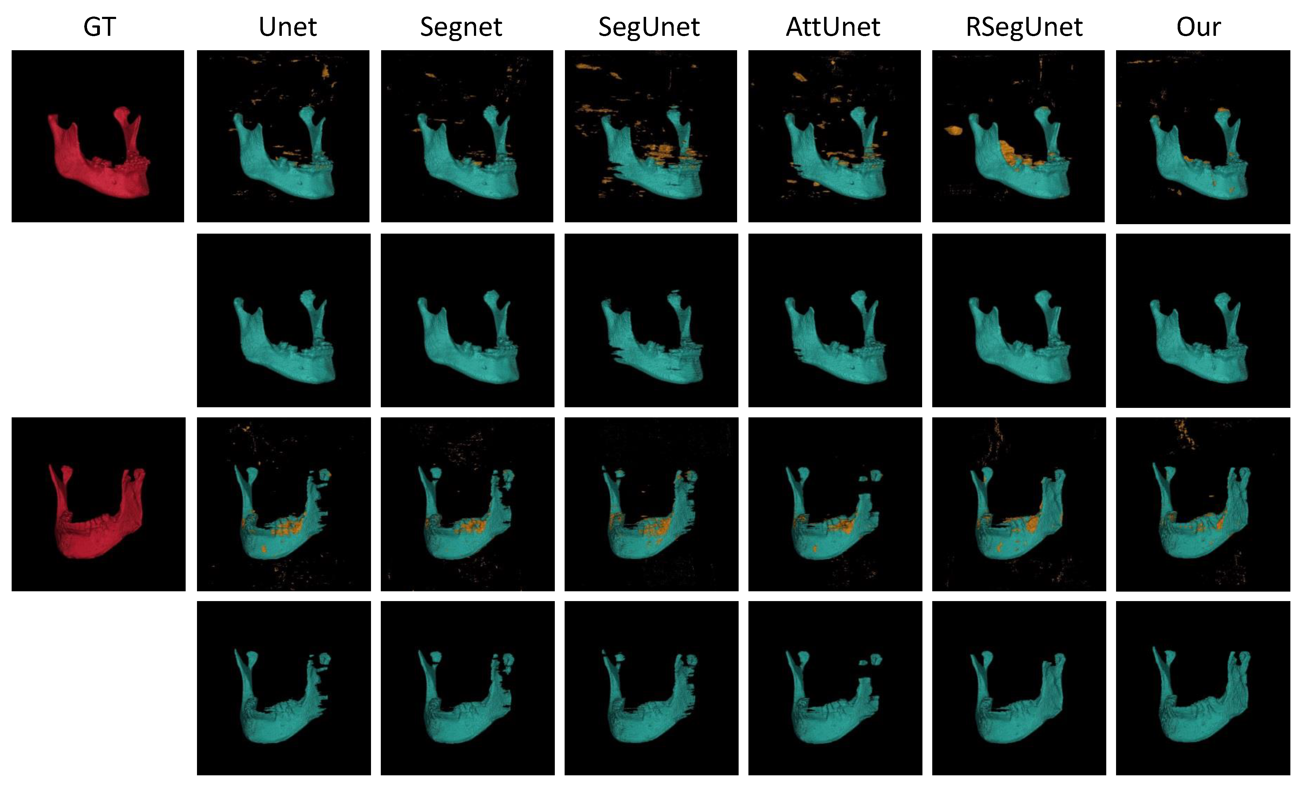 Jpm 11 00560 g005 Jpm 11 00560 g005