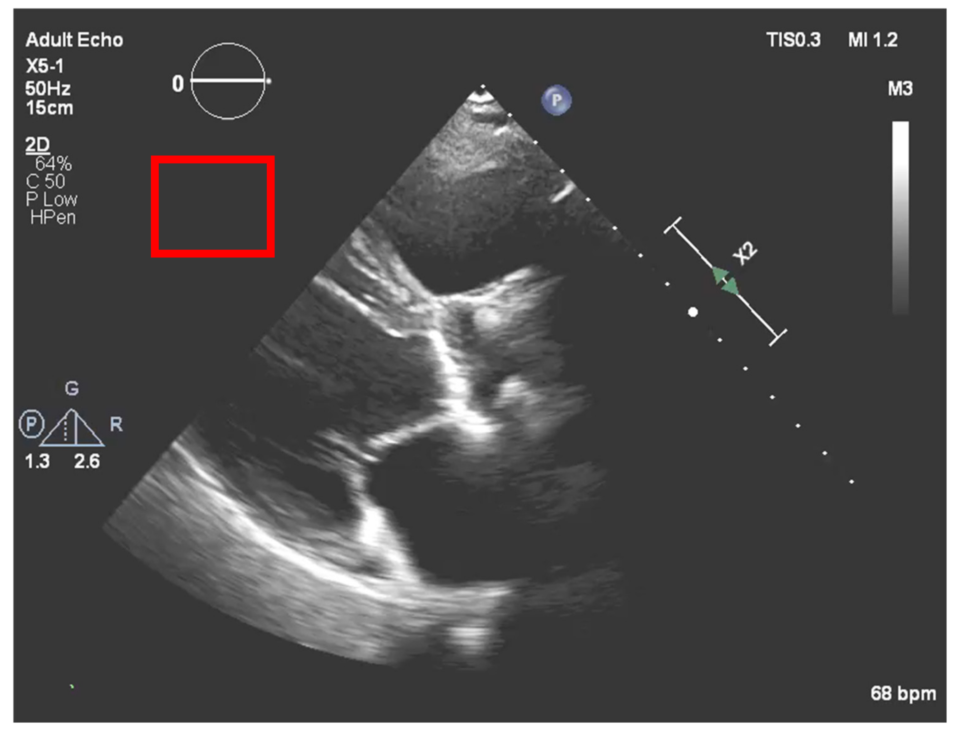 Jpm 11 00598 g007 550