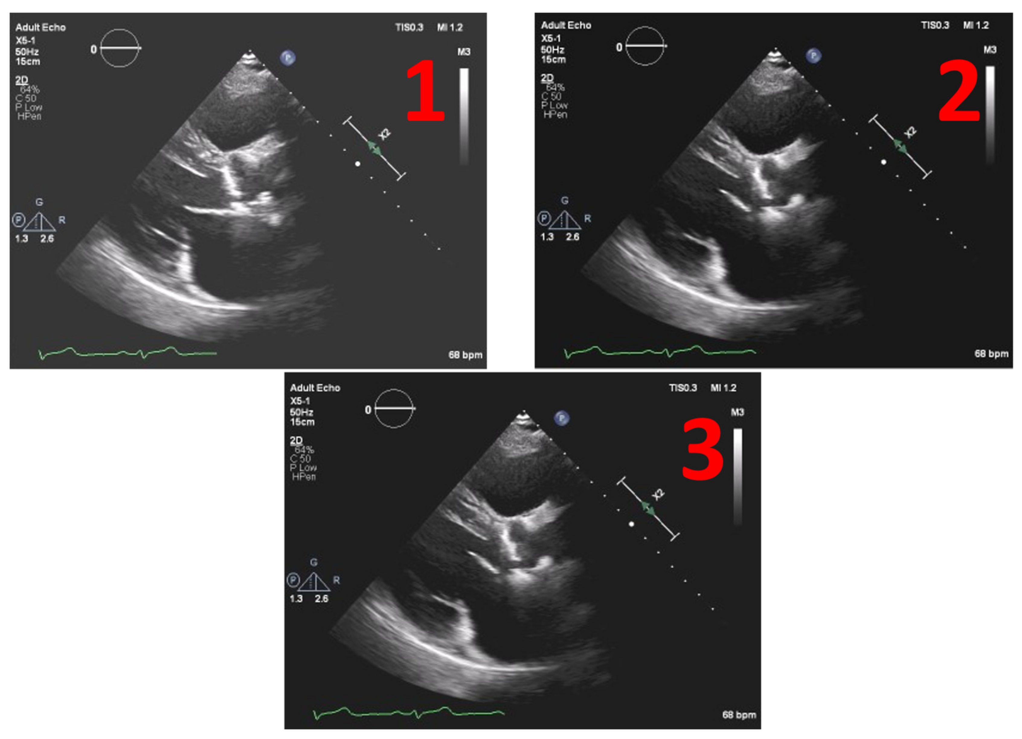 Jpm 11 00598 g008 550