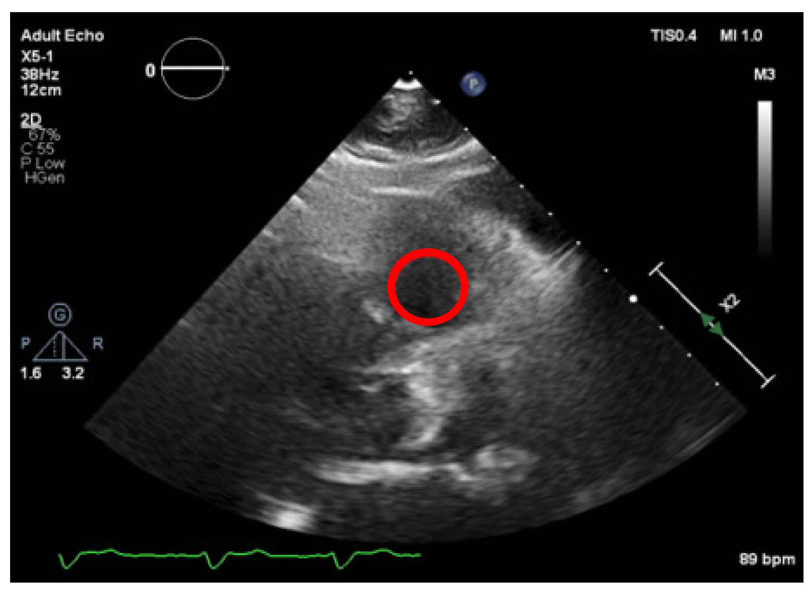 Jpm 11 00598 g010 550