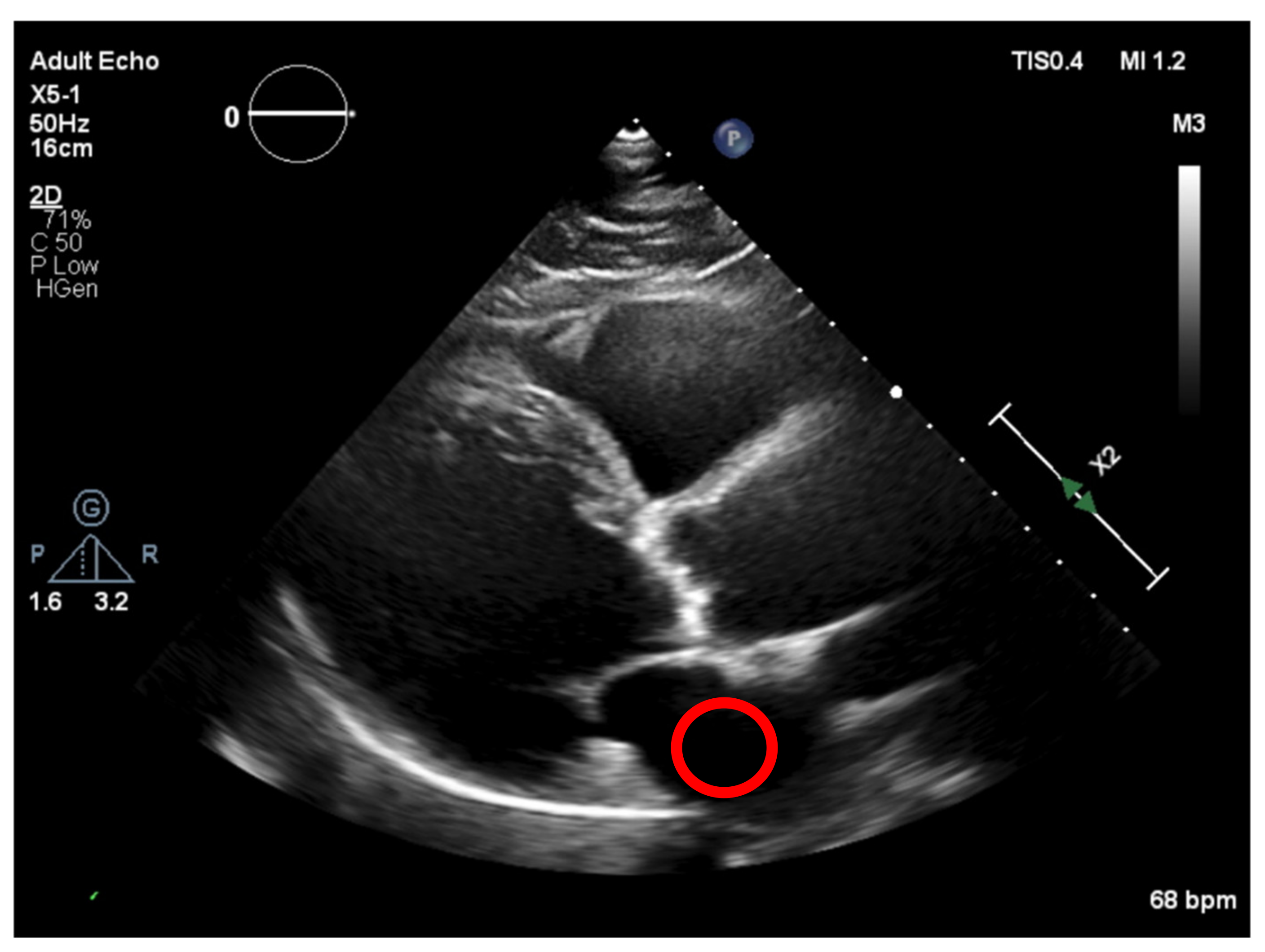 Jpm 11 00598 g011 550