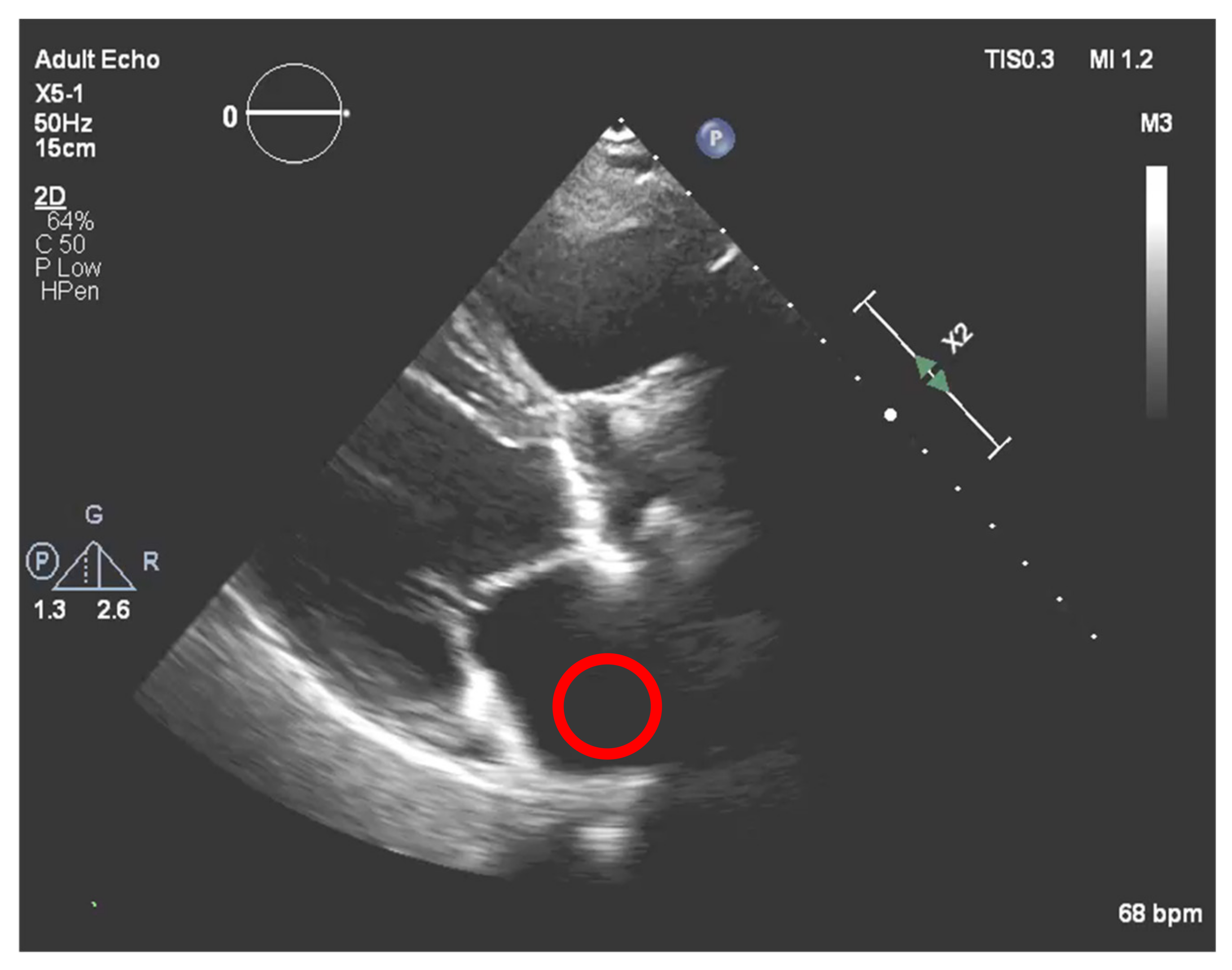 Jpm 11 00598 g017 550