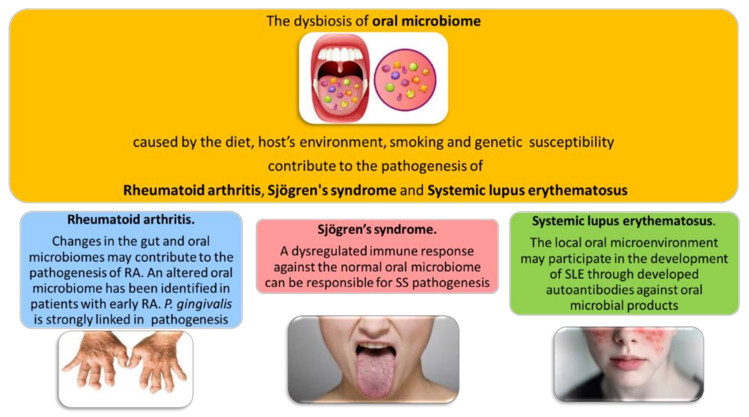 Dysbiosis rheumatoid arthritis,
