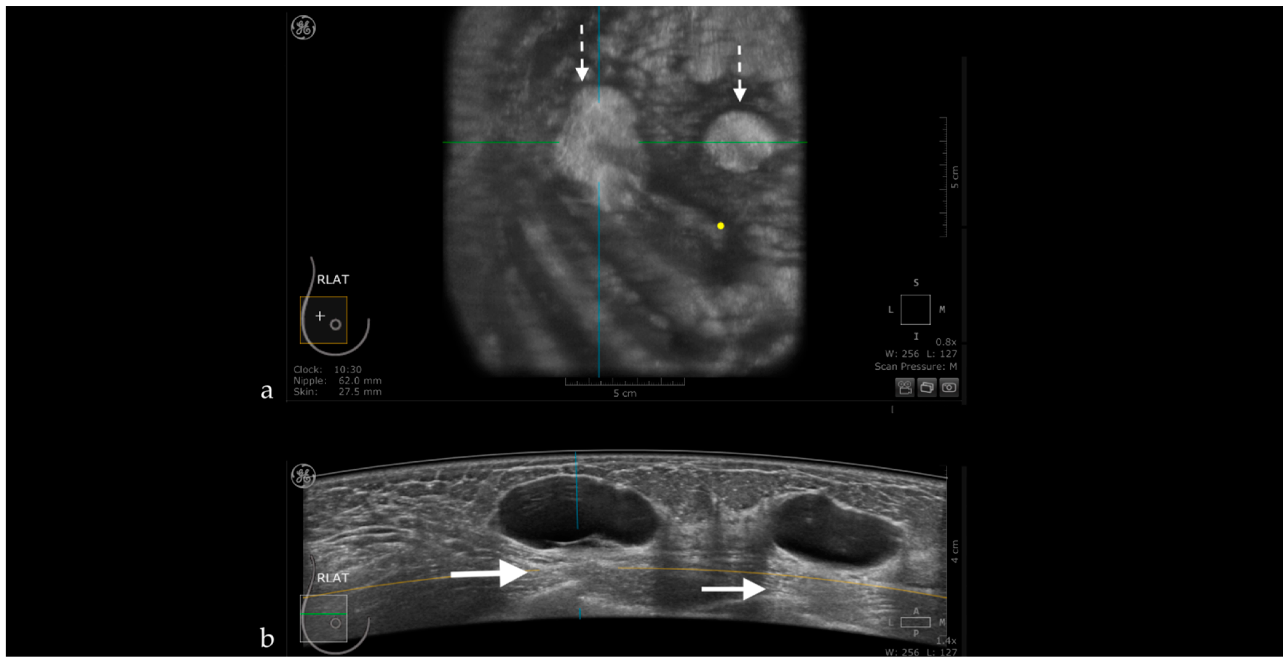 Jpm 11 00703 g008 Jpm 11 00703 g008