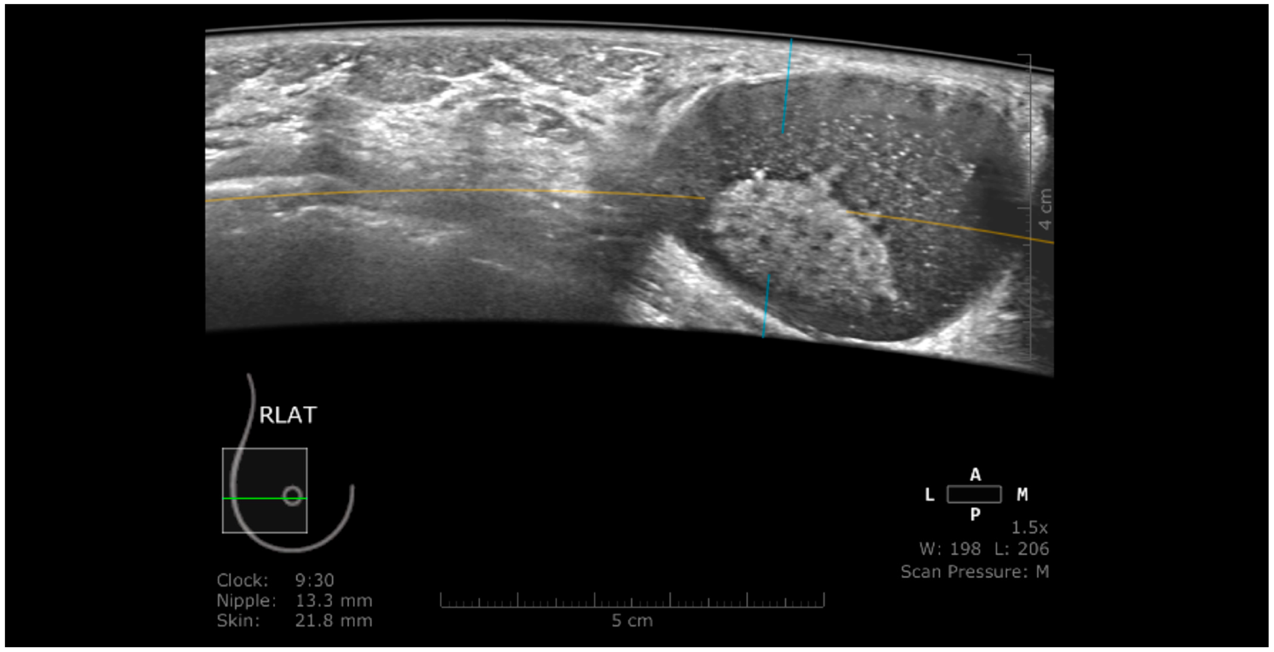 Jpm 11 00703 g009 Jpm 11 00703 g009