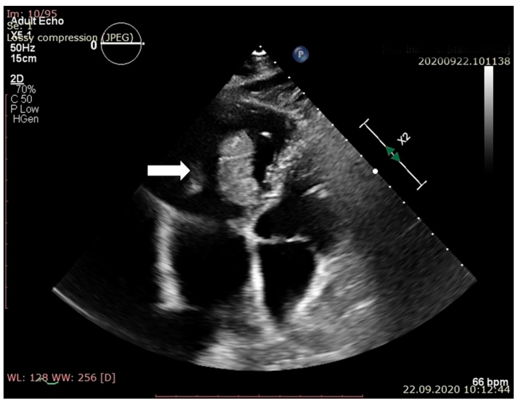 Jpm 11 00728 g001 550