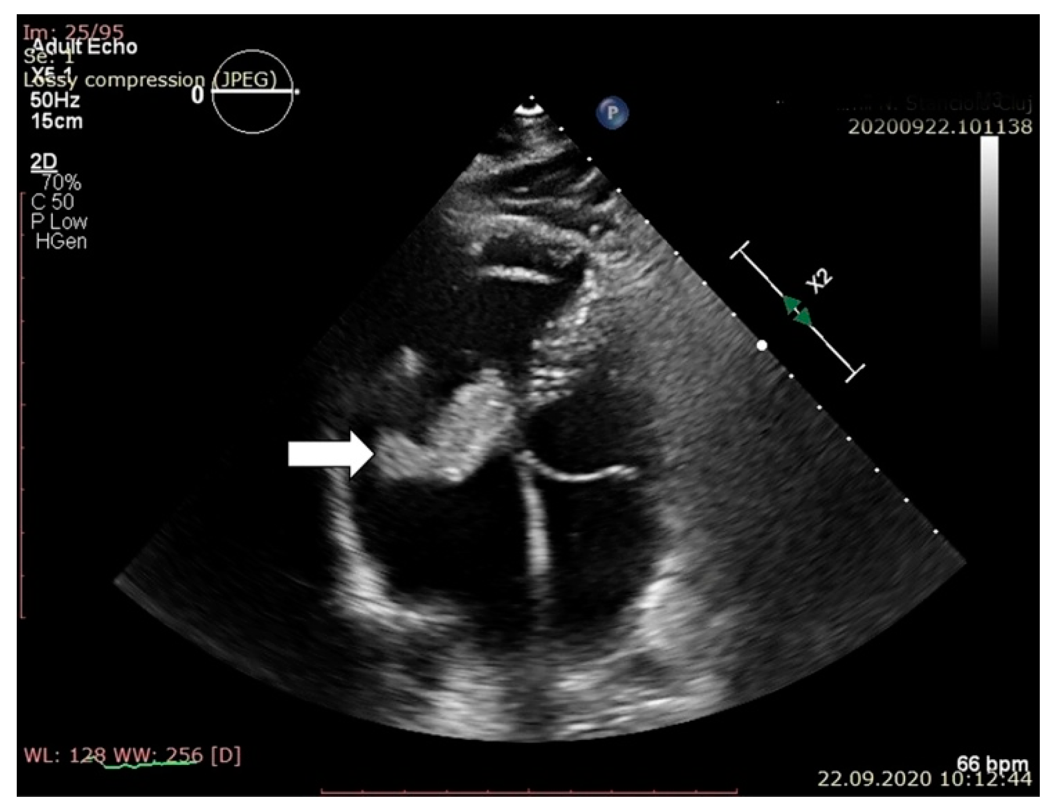 Jpm 11 00728 g002 550