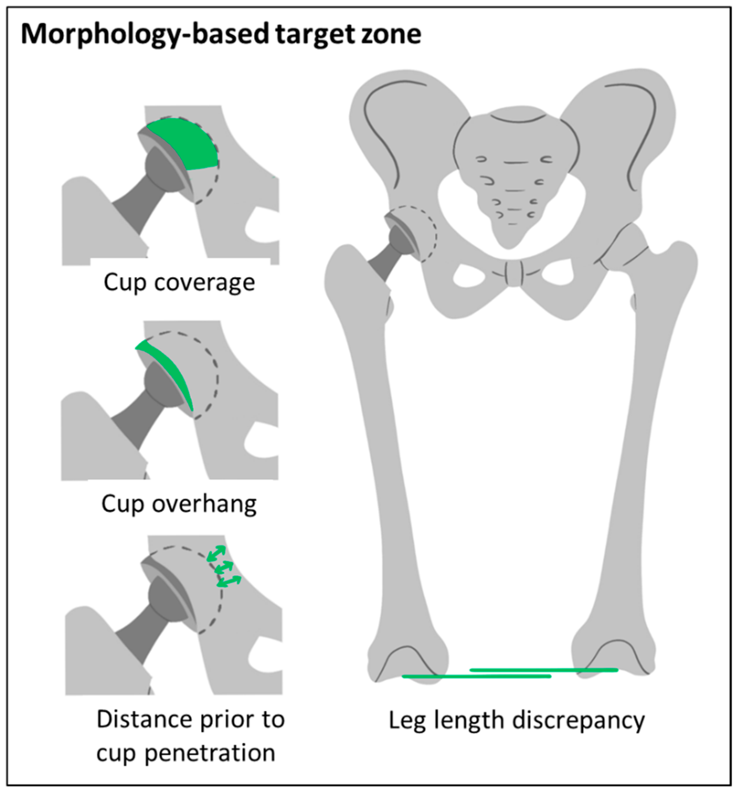 JPM Free FullText The PatientSpecific Combined Target Zone for