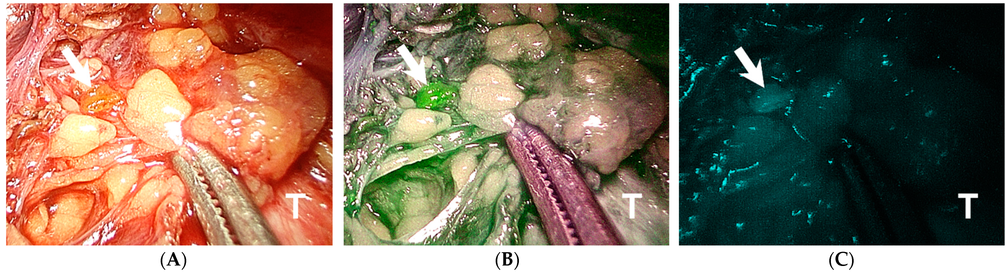 Jpm 11 00843 g001 550