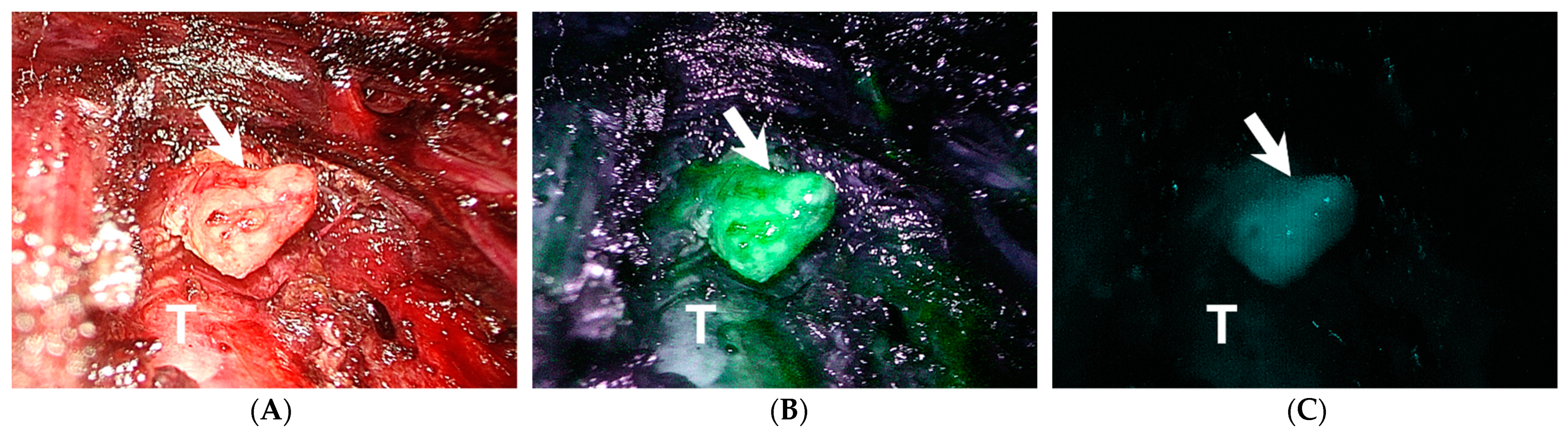 Jpm 11 00843 g003 550