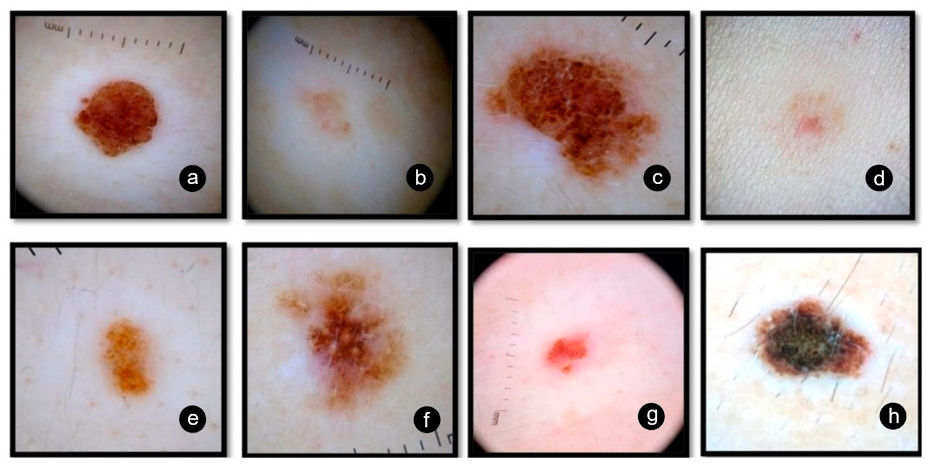 Jpm 11 00904 g001 Jpm 11 00904 g001