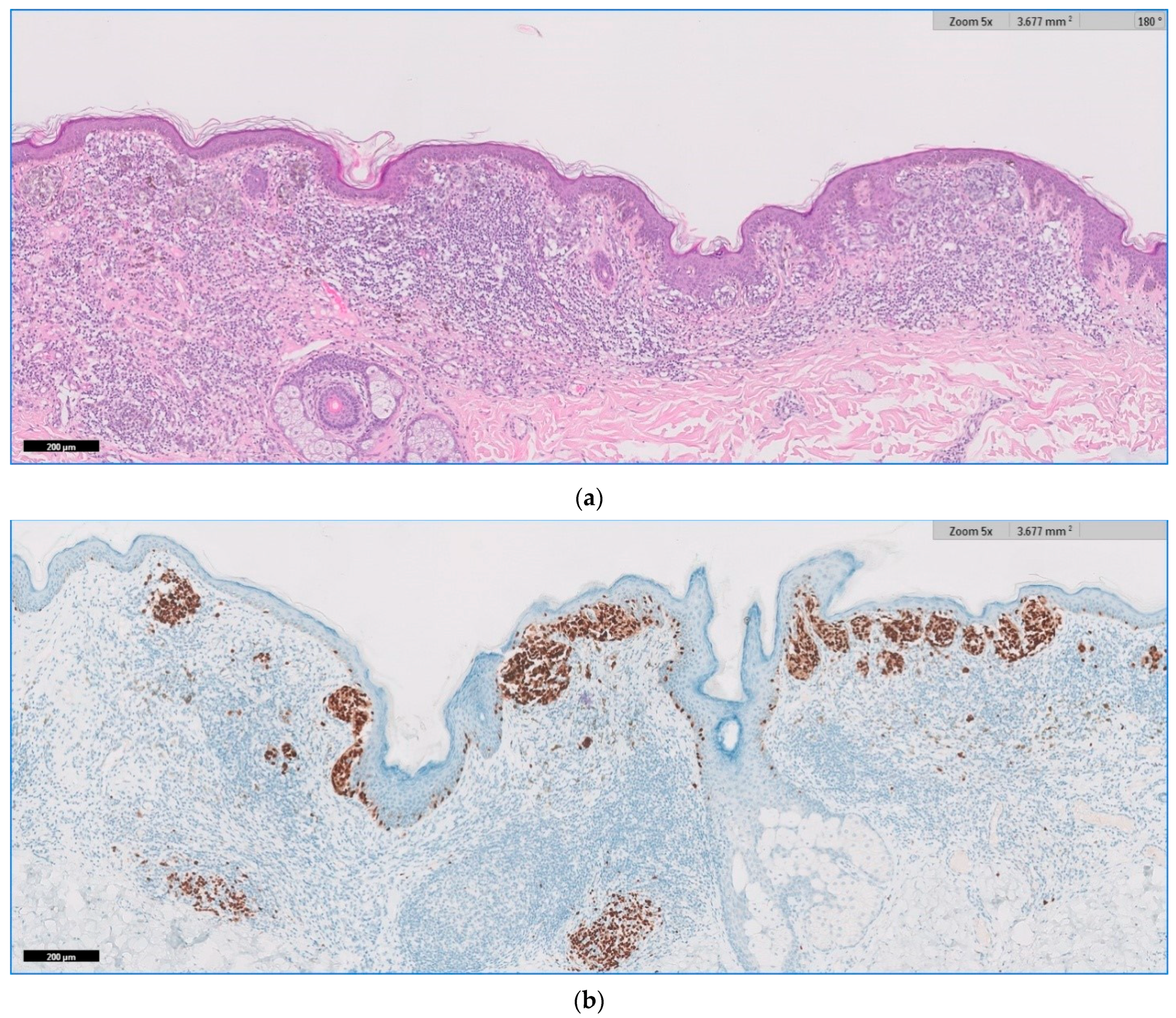 Jpm 11 00904 g005 Jpm 11 00904 g005