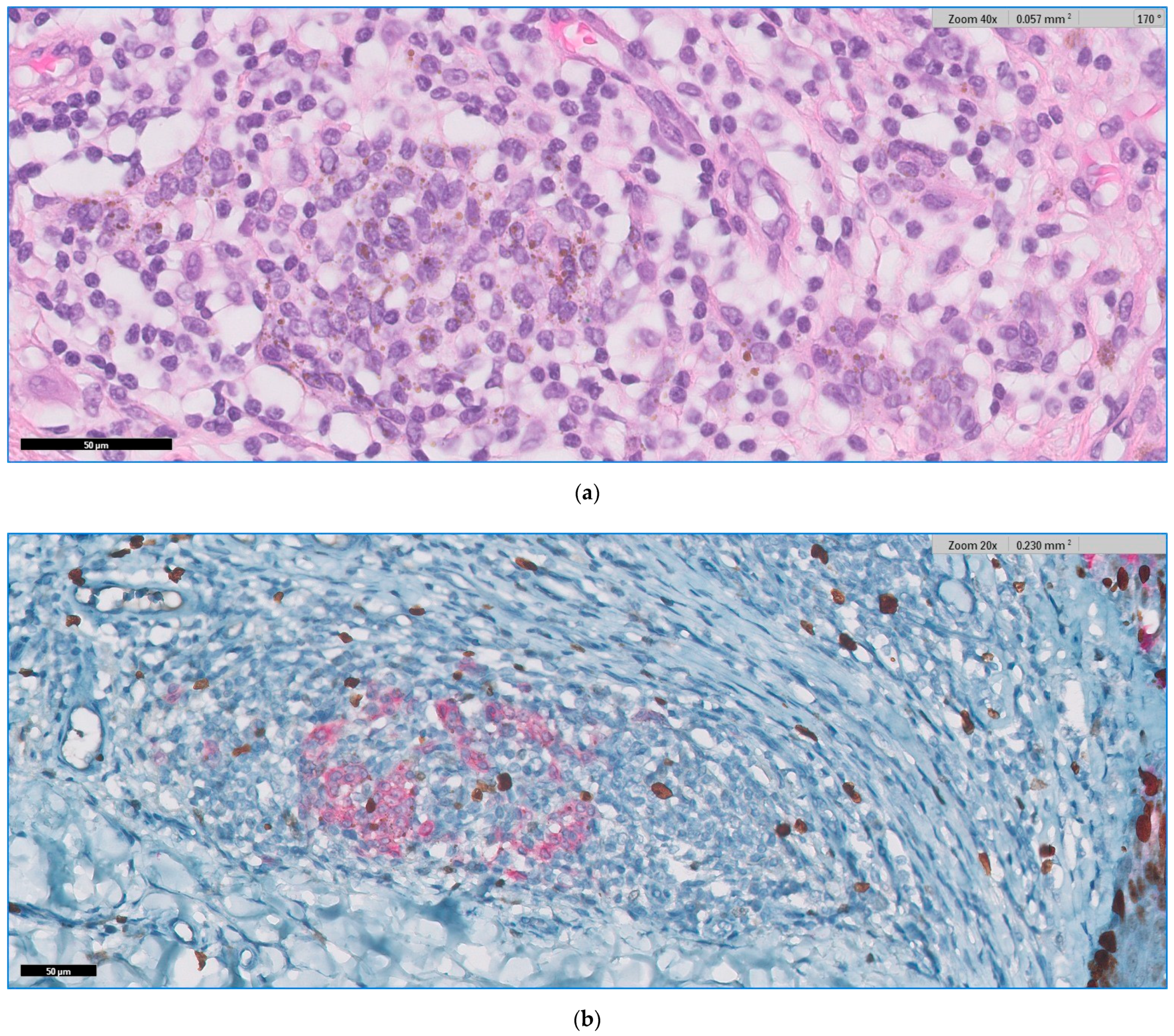 Jpm 11 00904 g007 Jpm 11 00904 g007