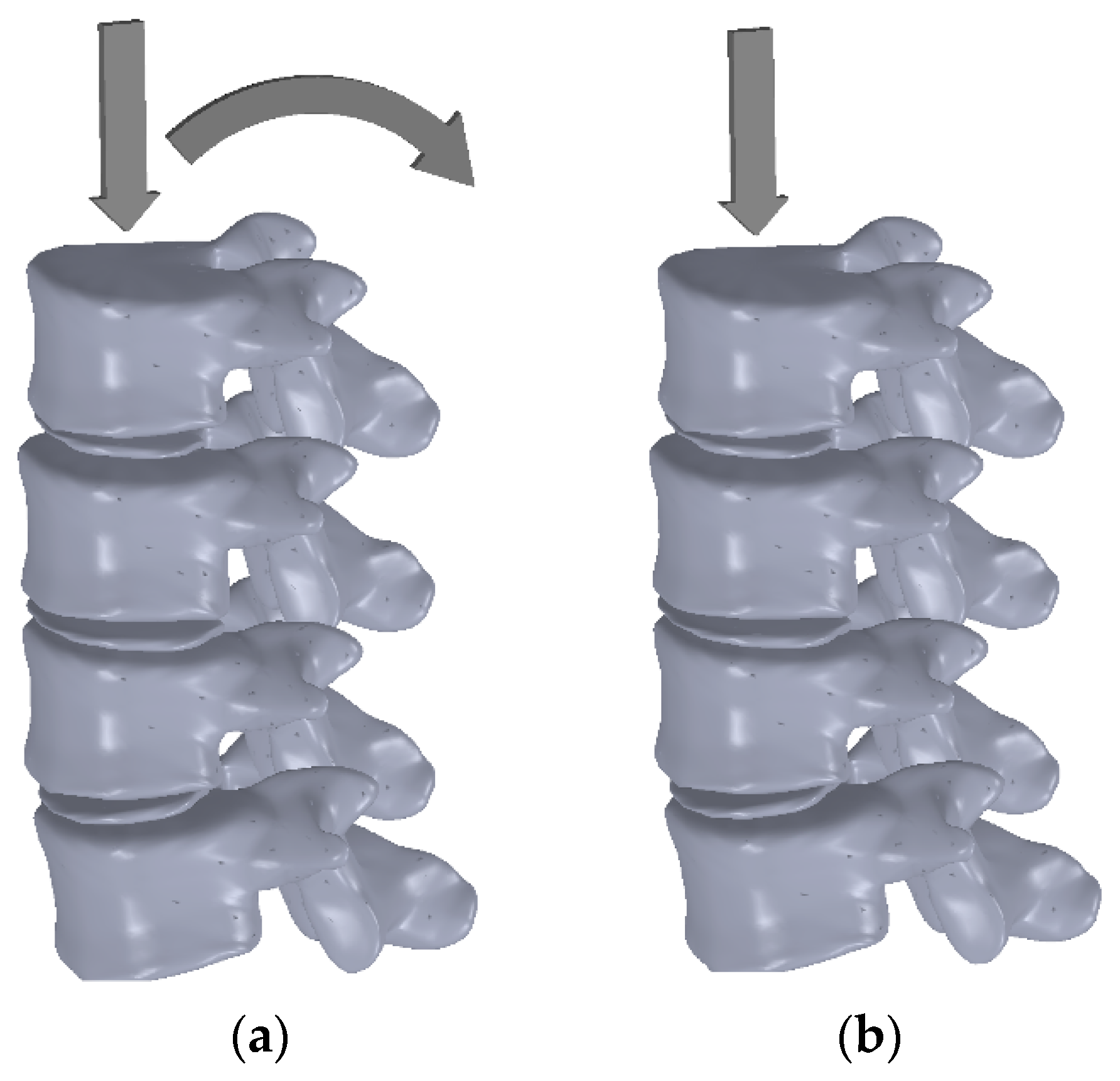 いま人気のアイテム Biomechanical Study Fracture Spine Osteoporotic the of 医学一般