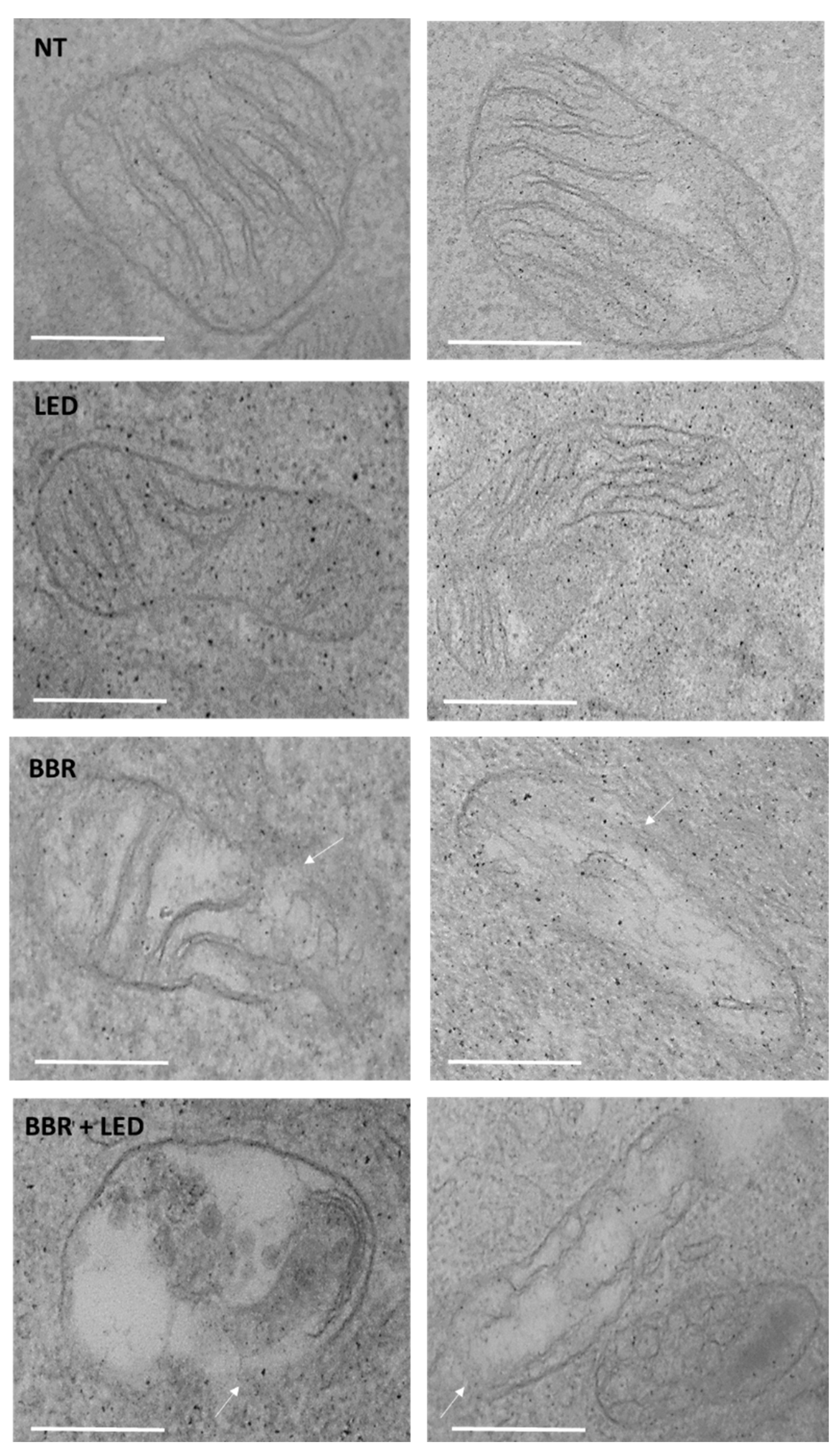 Jpm 11 00942 g013 Jpm 11 00942 g013