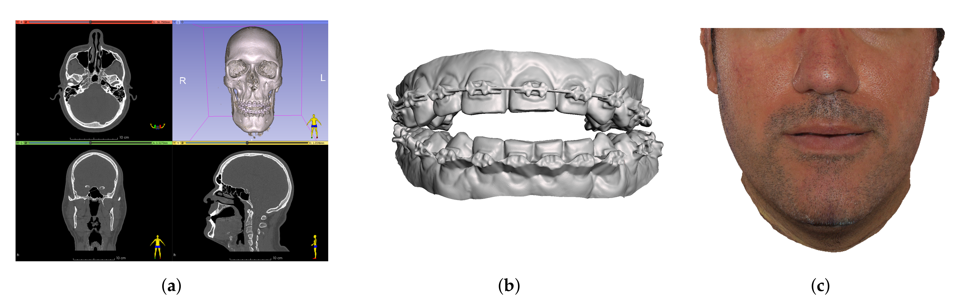 Jpm 11 00982 g003 Jpm 11 00982 g003