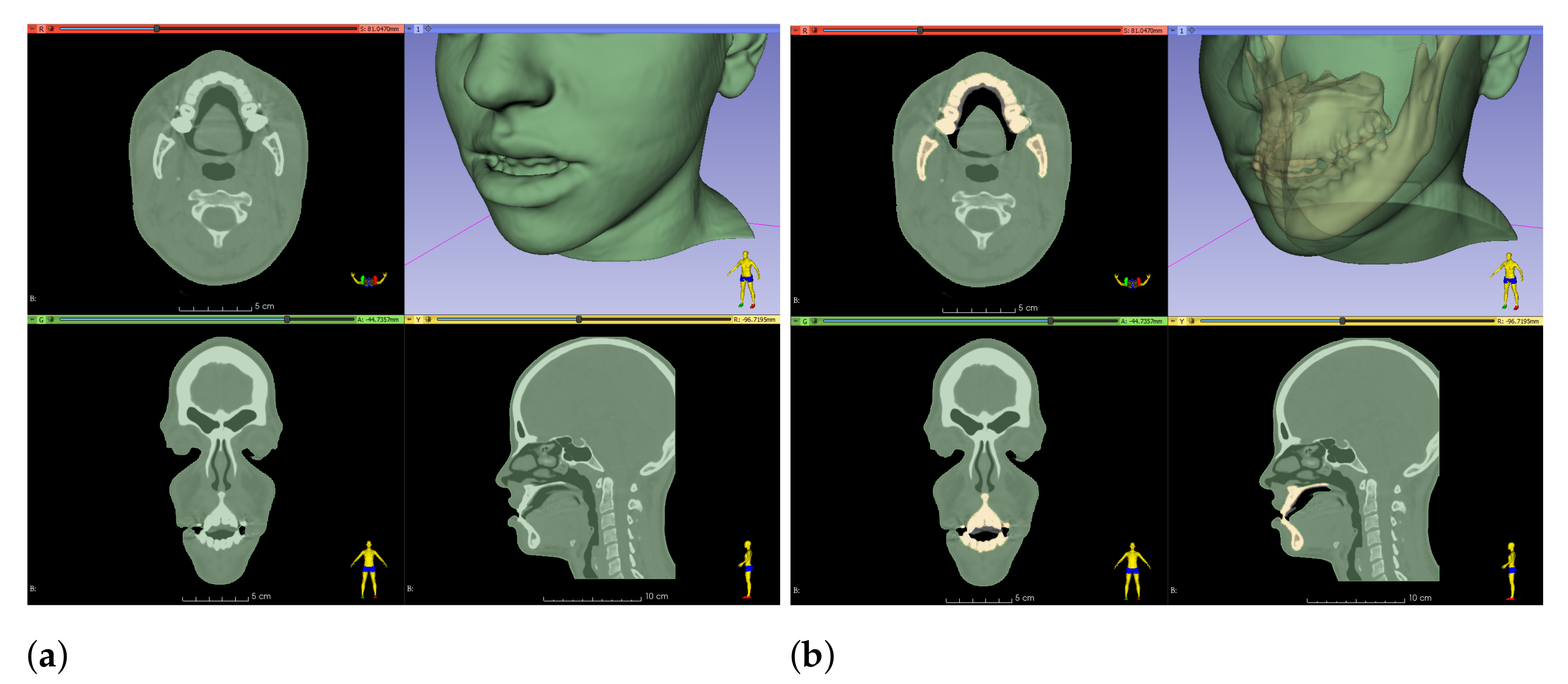 Jpm 11 00982 g004 Jpm 11 00982 g004