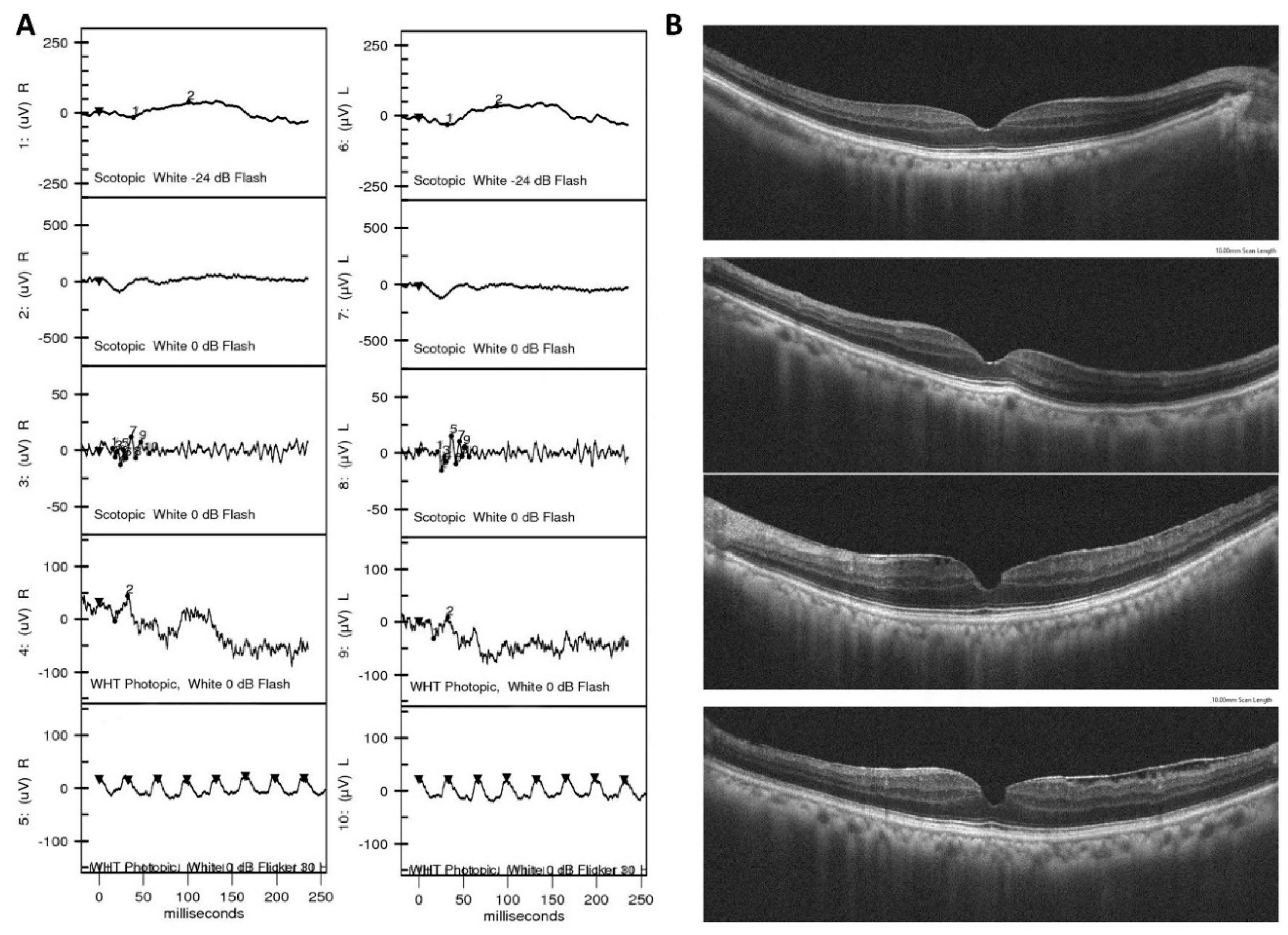 Jpm 11 01022 g006 Jpm 11 01022 g006