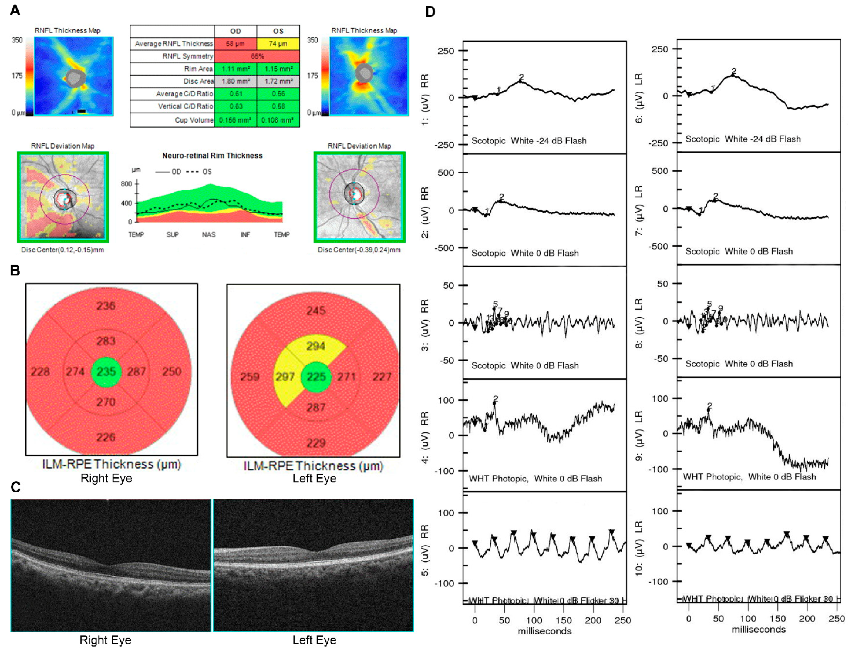 Jpm 11 01022 g007 Jpm 11 01022 g007