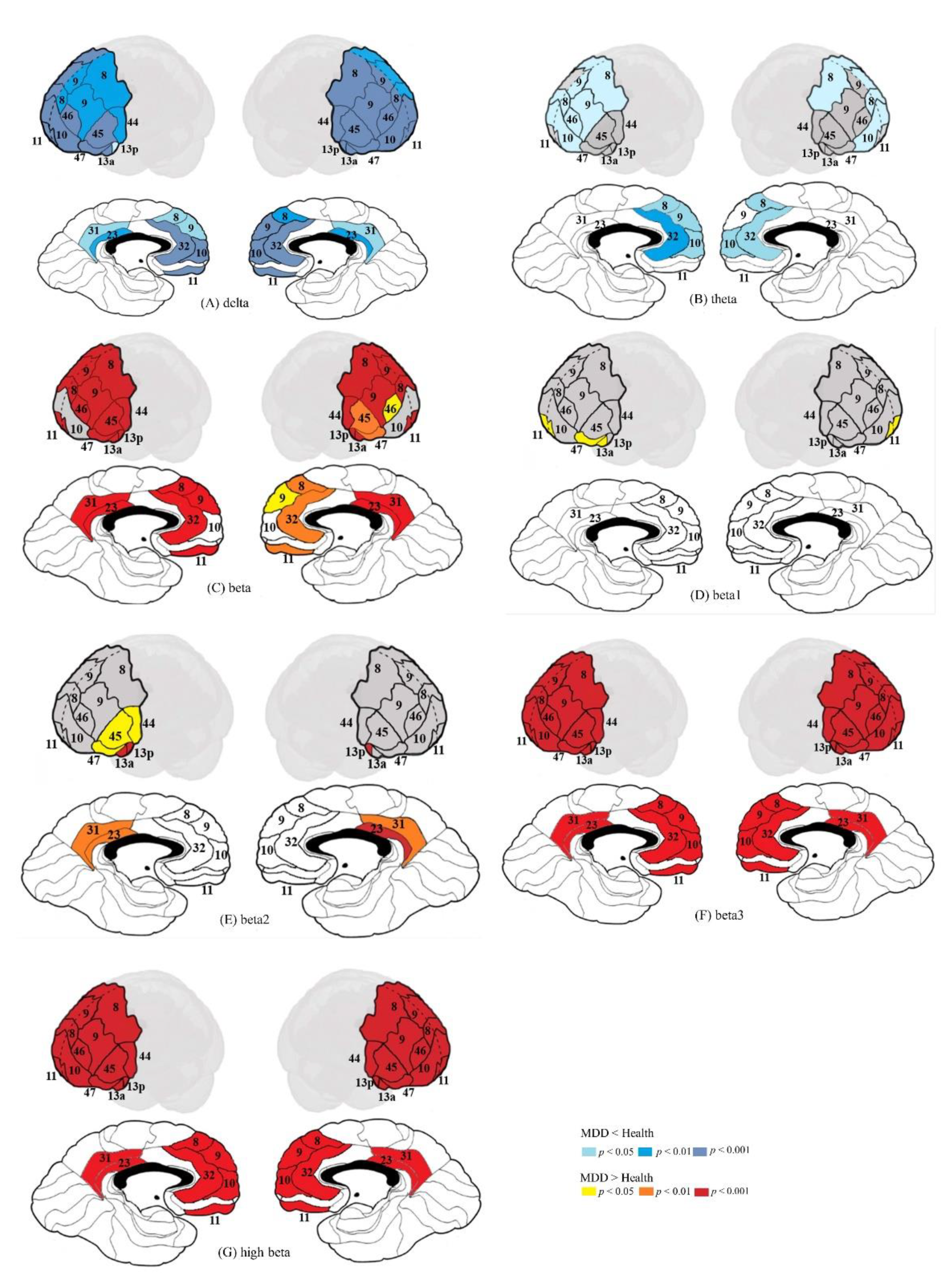 Prefrontal Lobe and Posterior Cingulate Cortex Activations in Patients with  Major Depressive Disorder by Using Standardized Weighted Low-Resolution  Electromagnetic Tomography