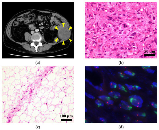 Establishment and Characterization of NCC-DDLPS4-C1: A Novel