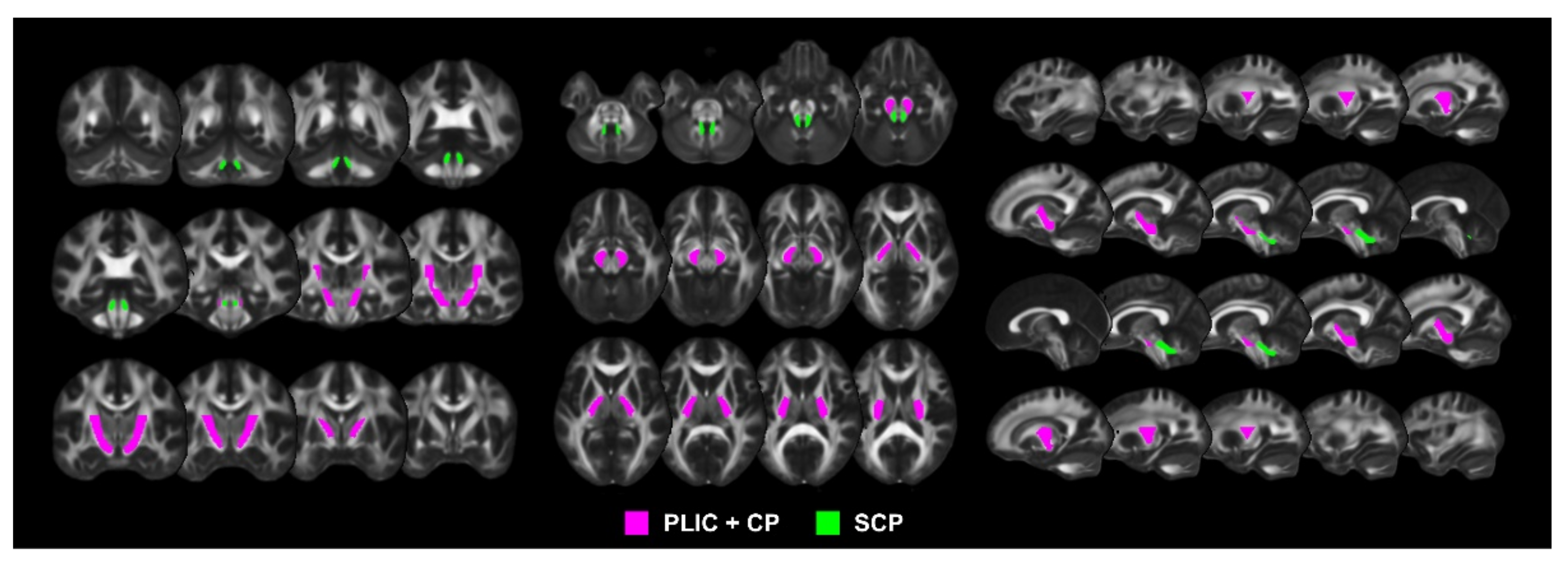 Jpm 11 01162 g002 550
