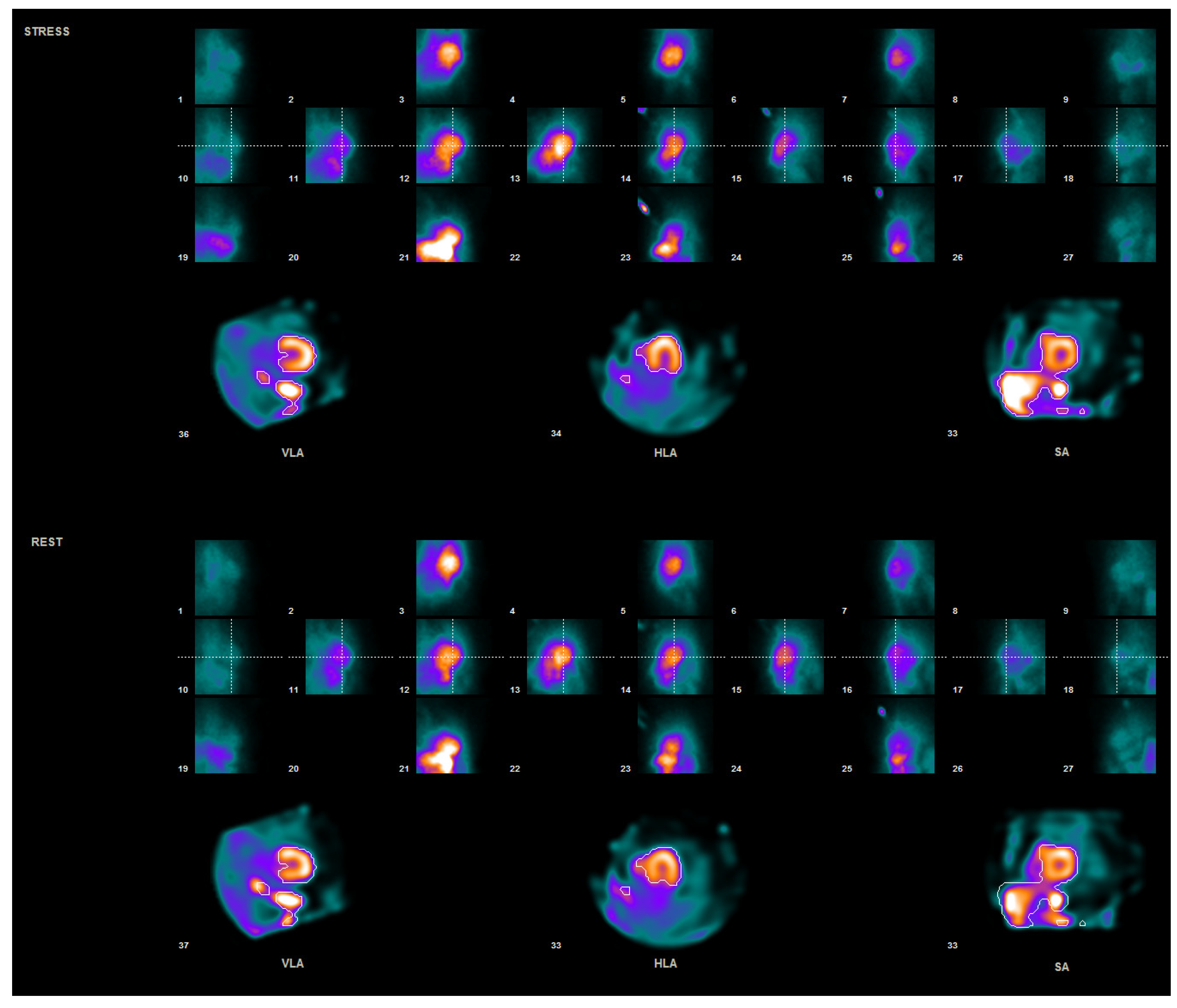 Jpm 11 01164 g001 550