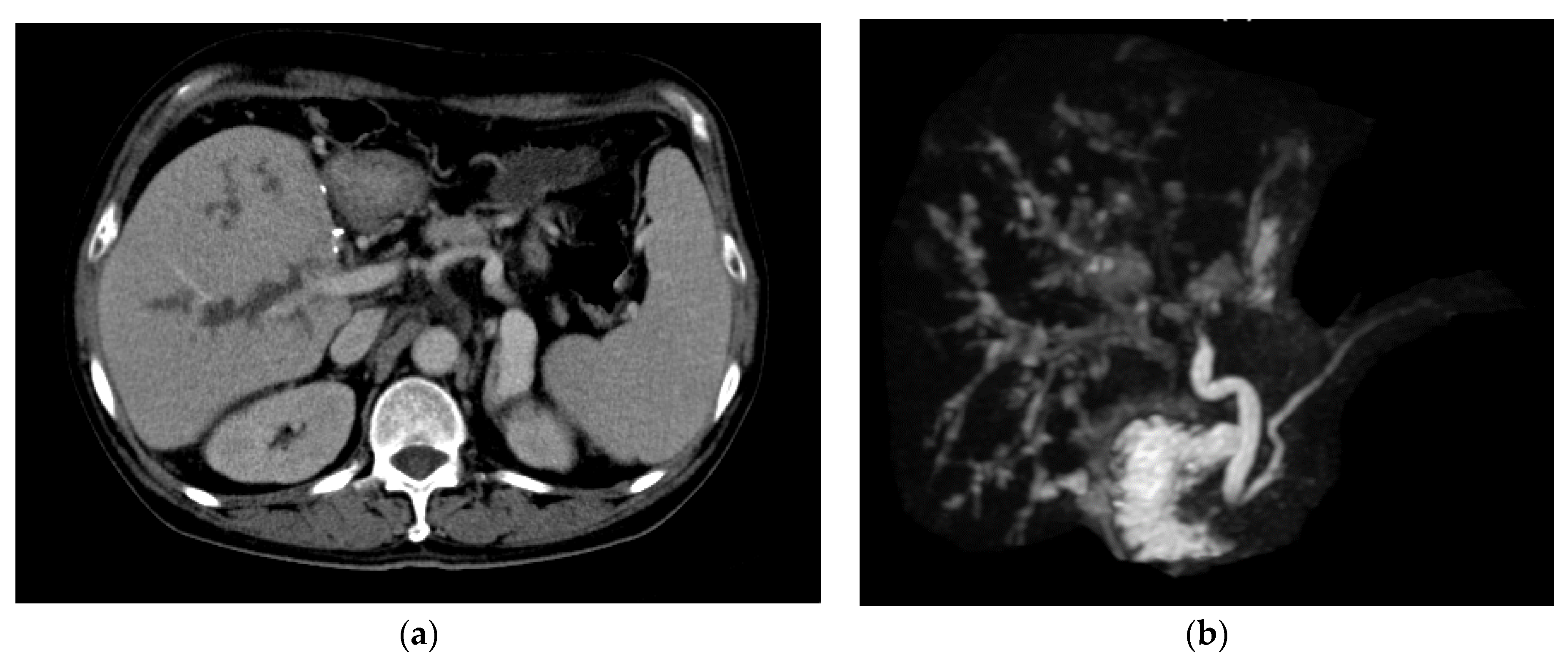 Jpm 11 01300 g004 550