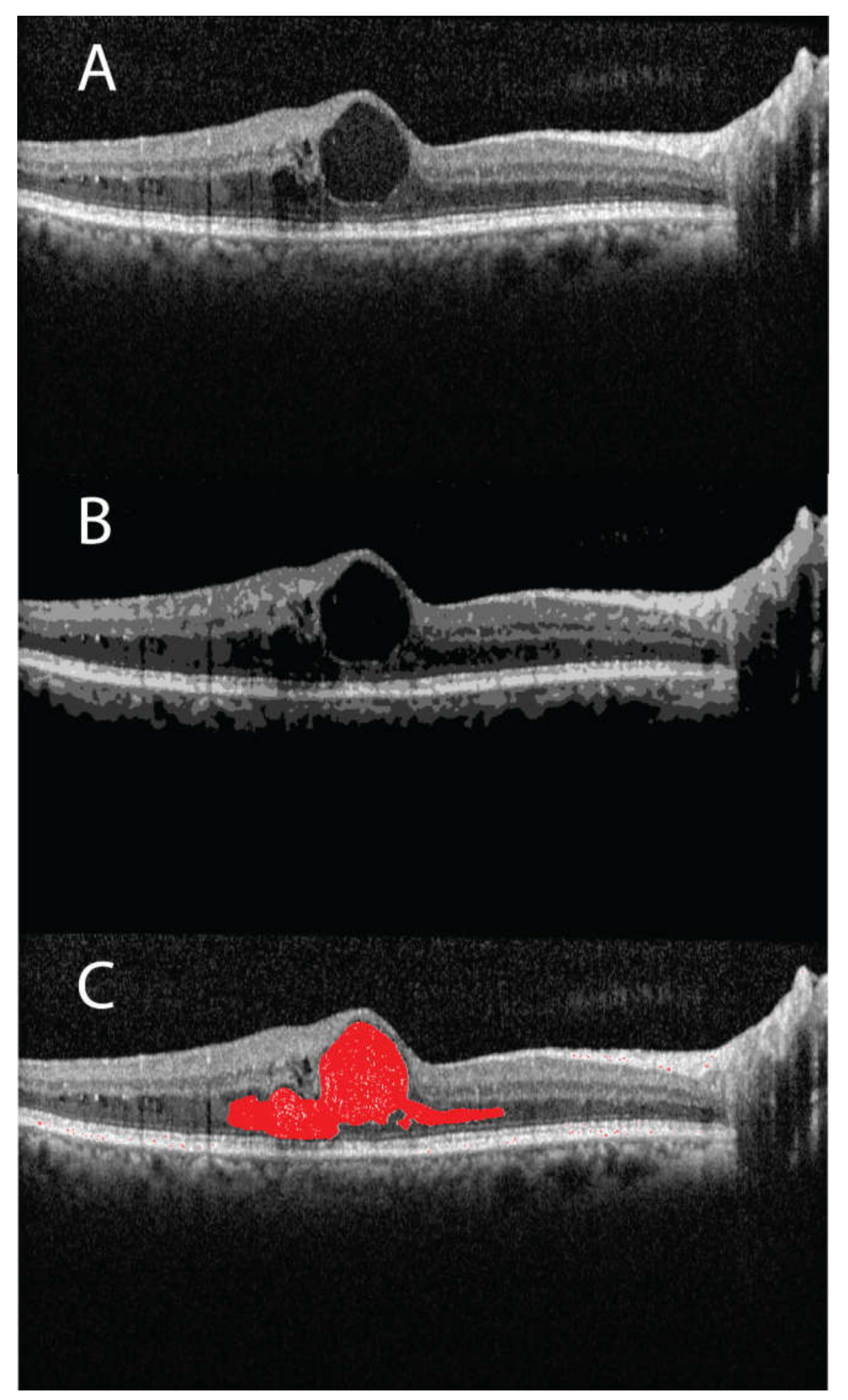 Jpm 11 01337 g004 550