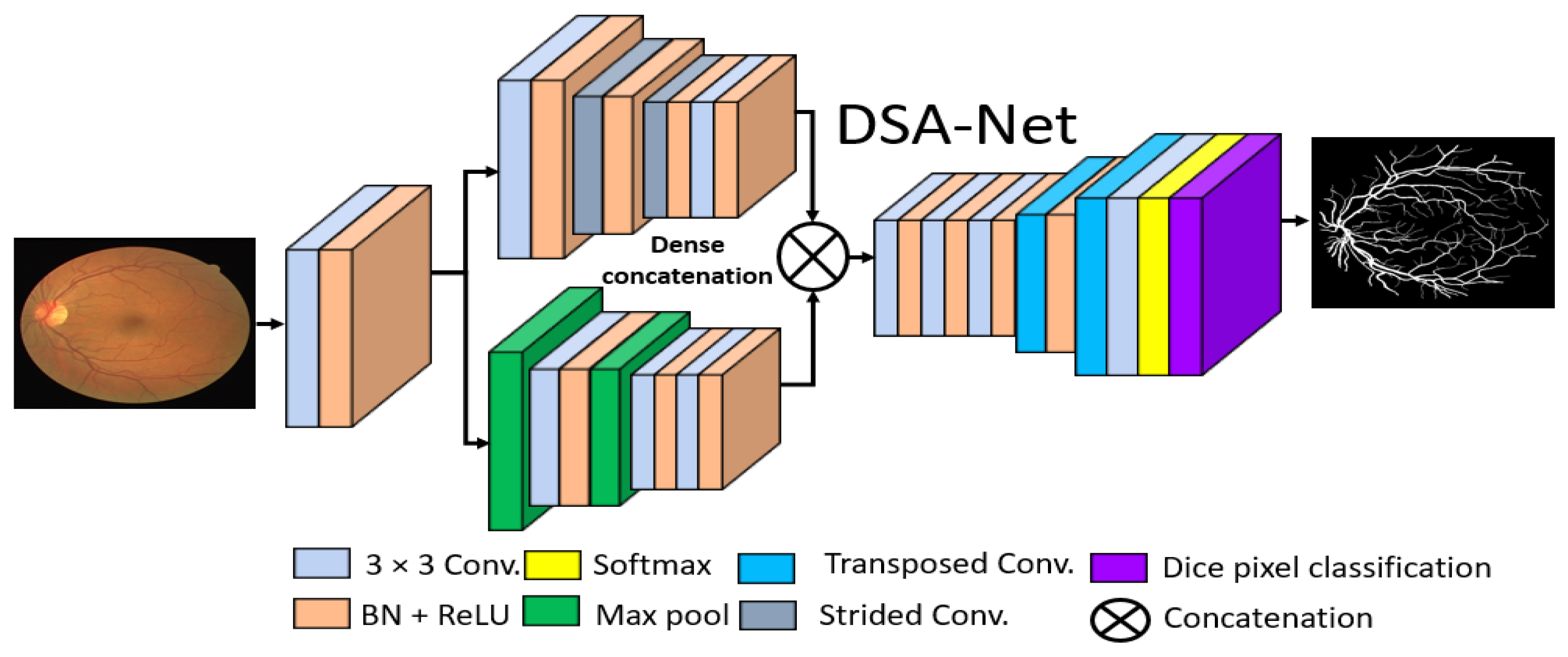 Diabetic and Hypertensive Retinopathy