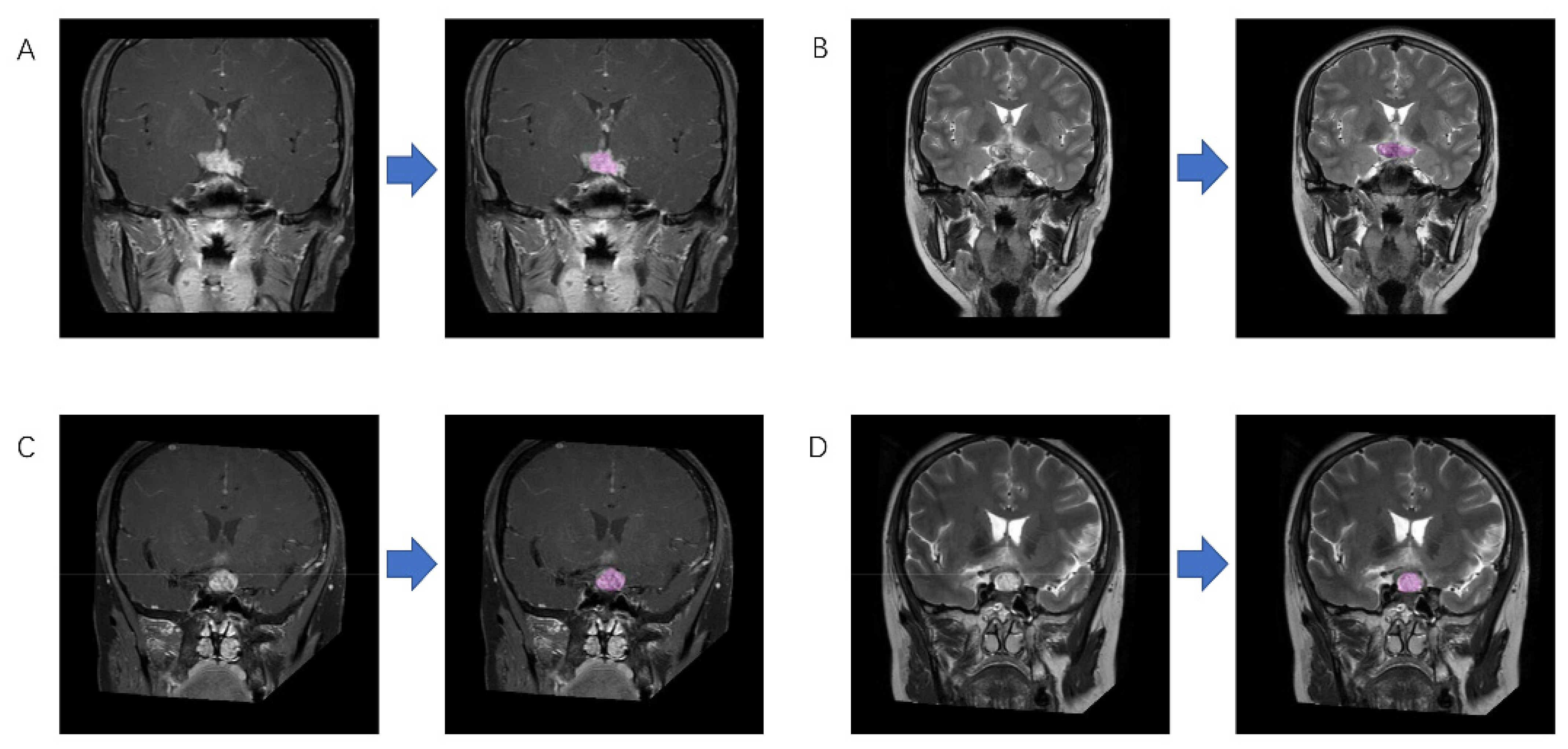 Jpm 12 00045 g002 550