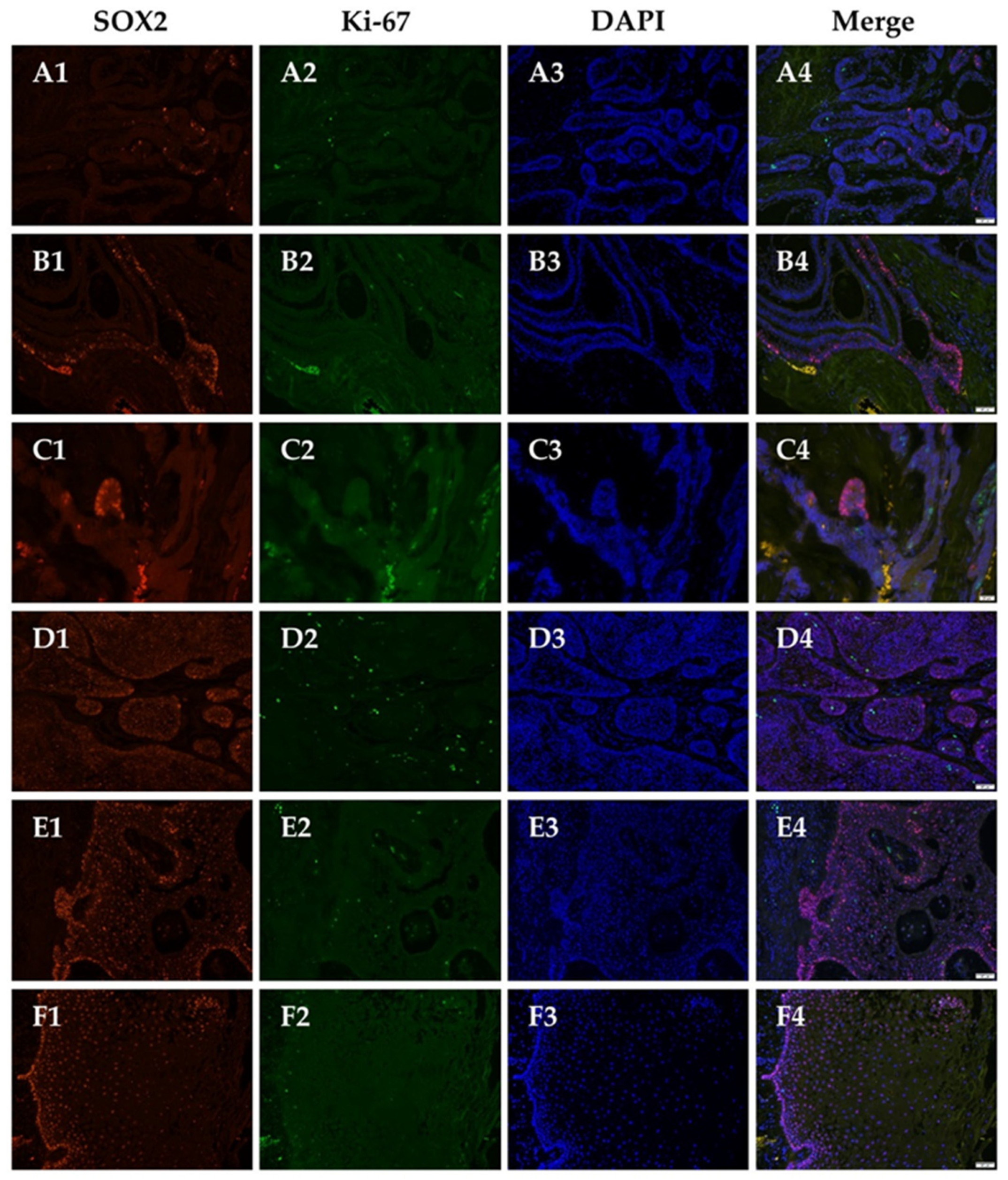 Jpm 12 00077 g004 550