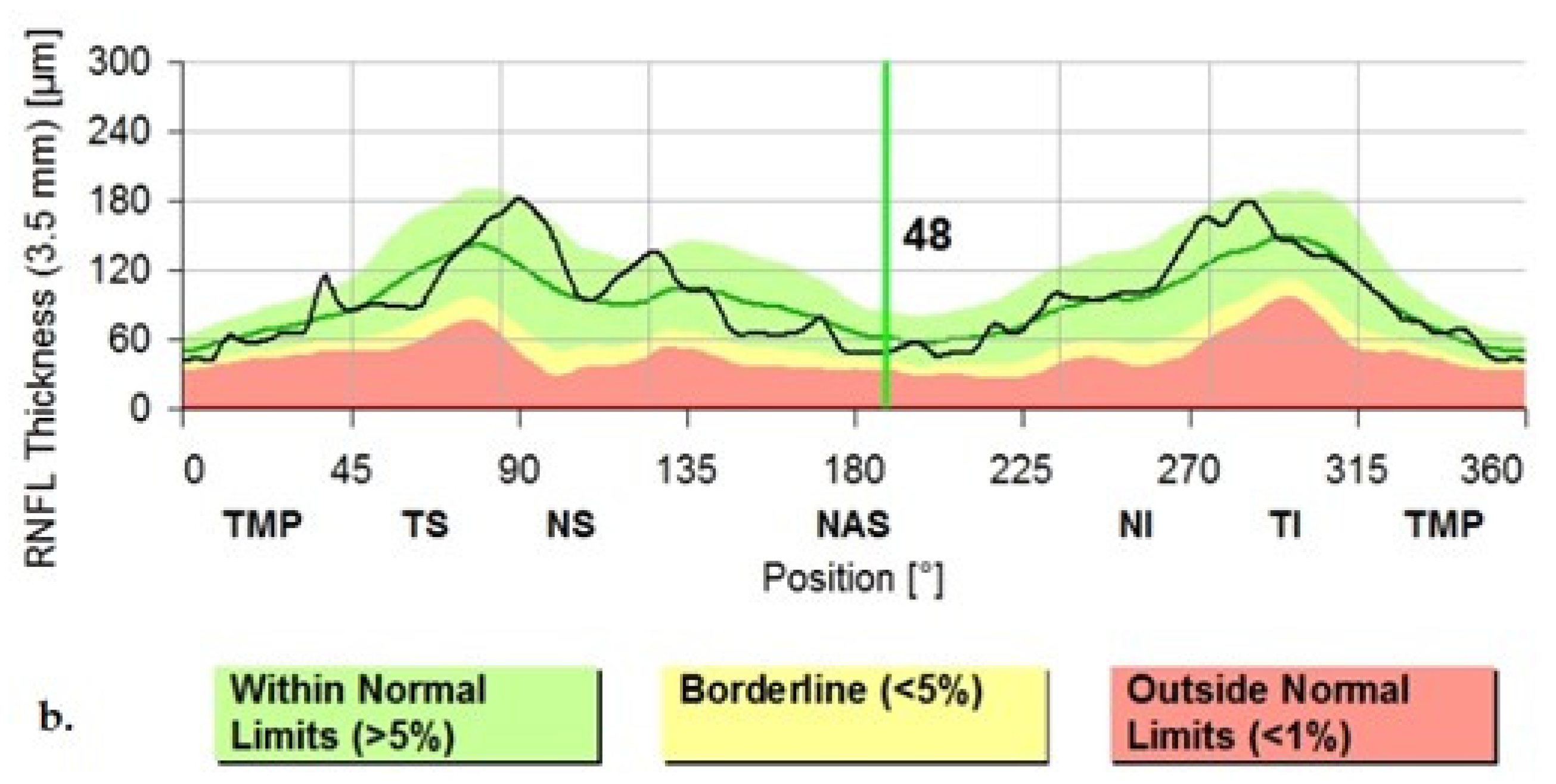 Jpm 12 00080 g004b 550