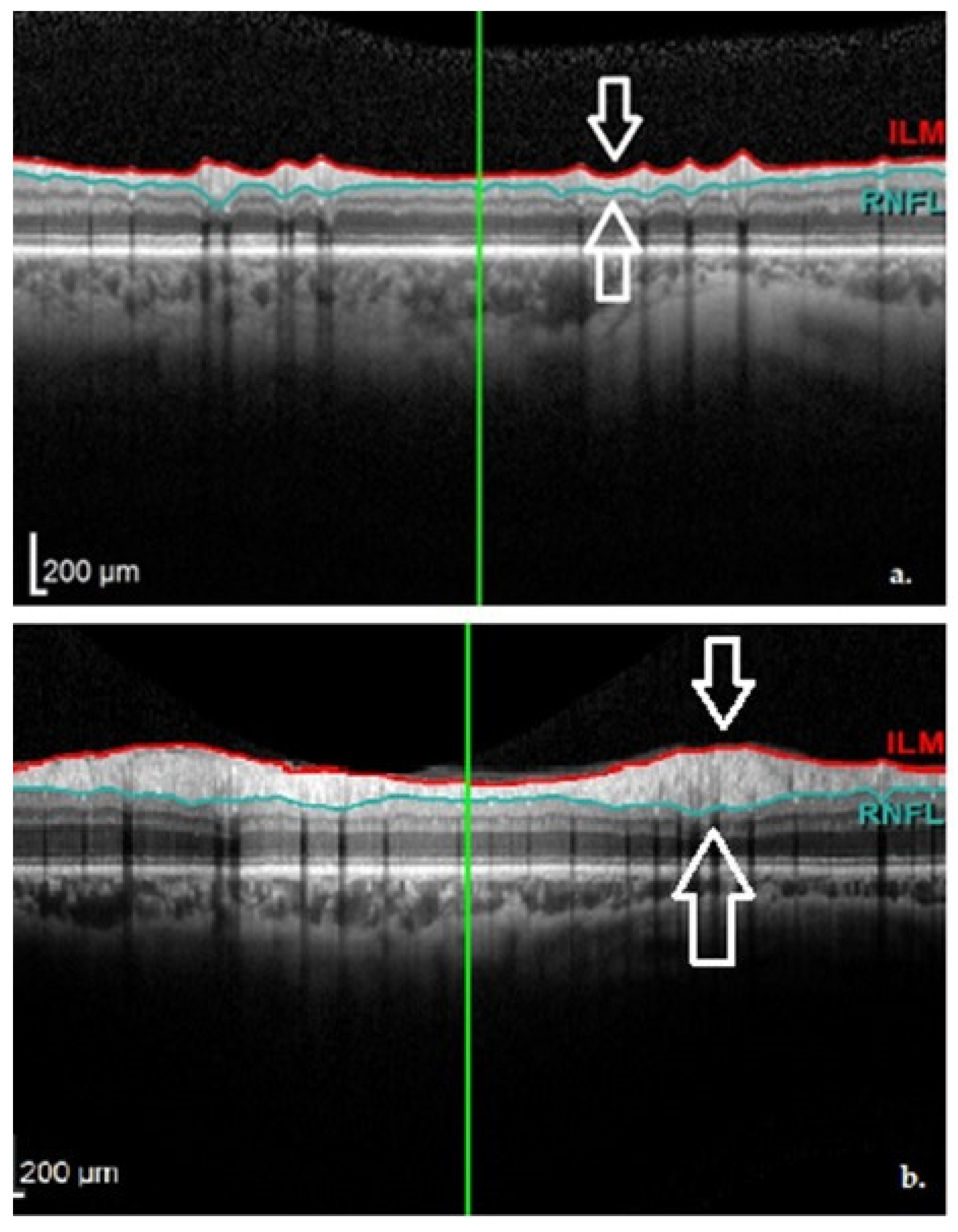 Jpm 12 00080 g005 550