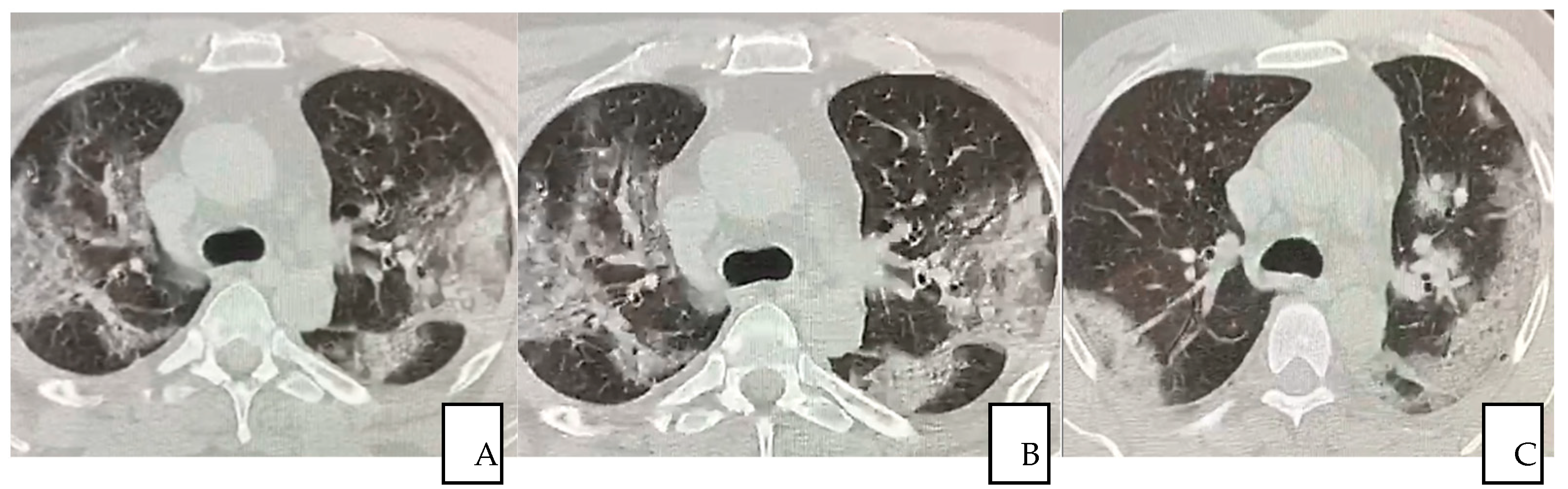 Jpm 12 00085 g004 Jpm 12 00085 g004