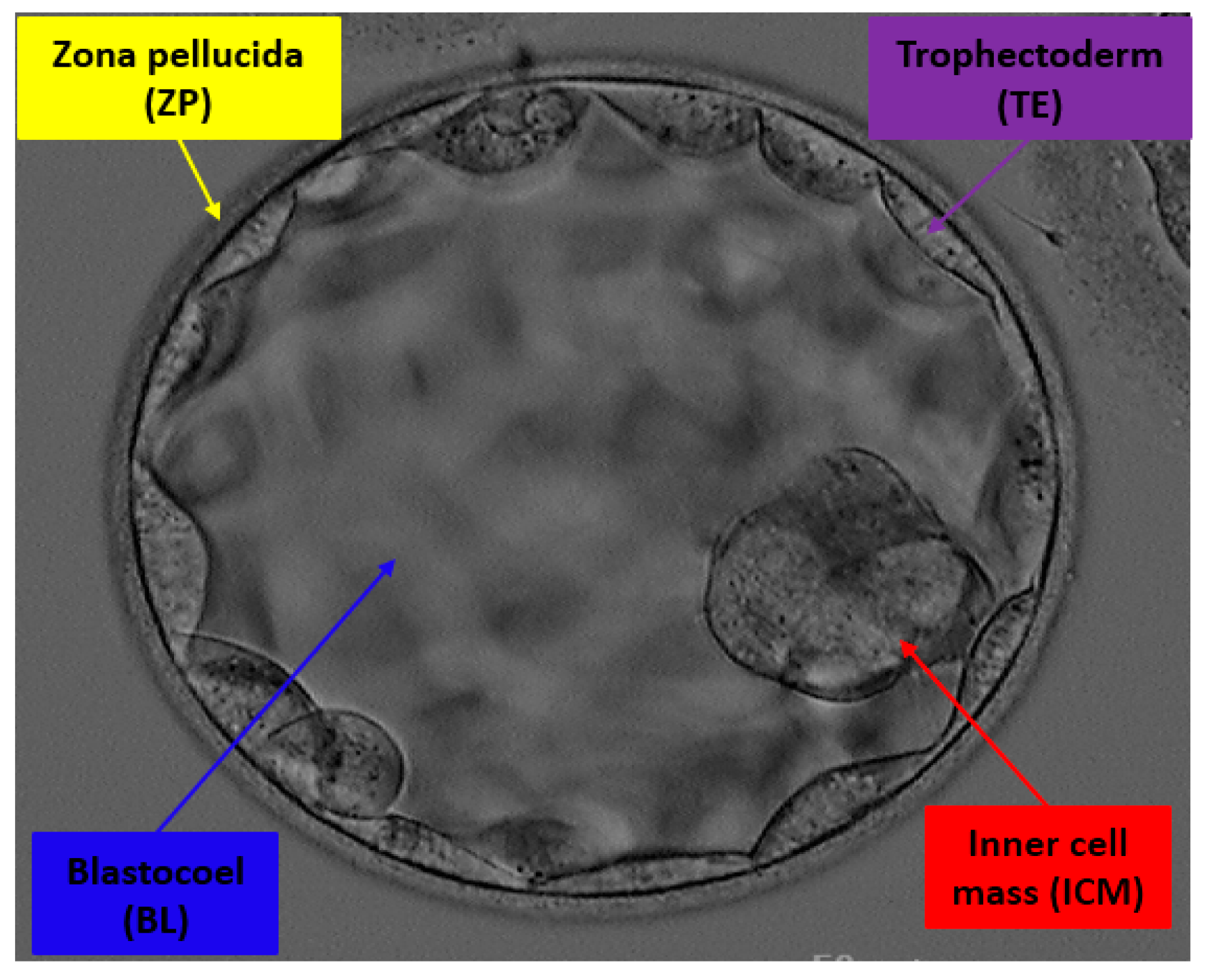 JPM | Free Full-Text | Detecting Blastocyst Components by Artificial  Intelligence for Human Embryological Analysis to Improve Success Rate of In  Vitro Fertilization