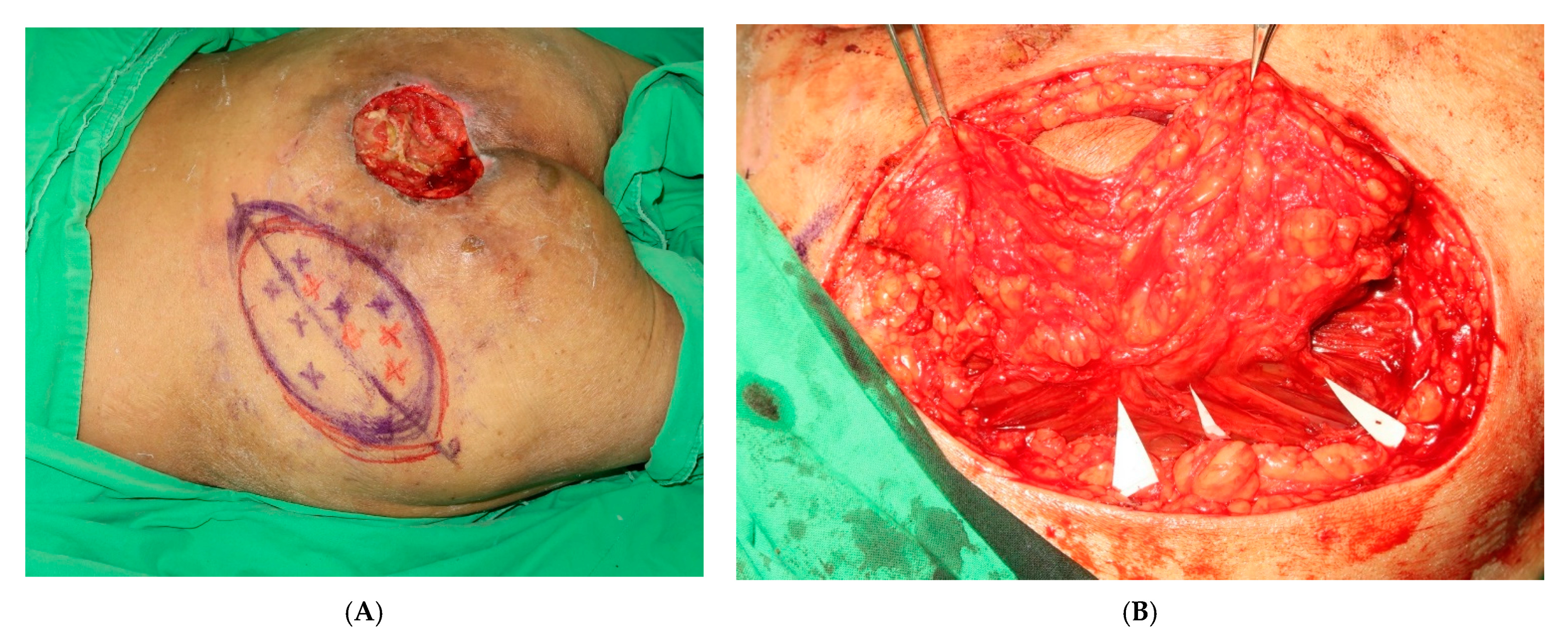 Jpm 12 00132 g002 550