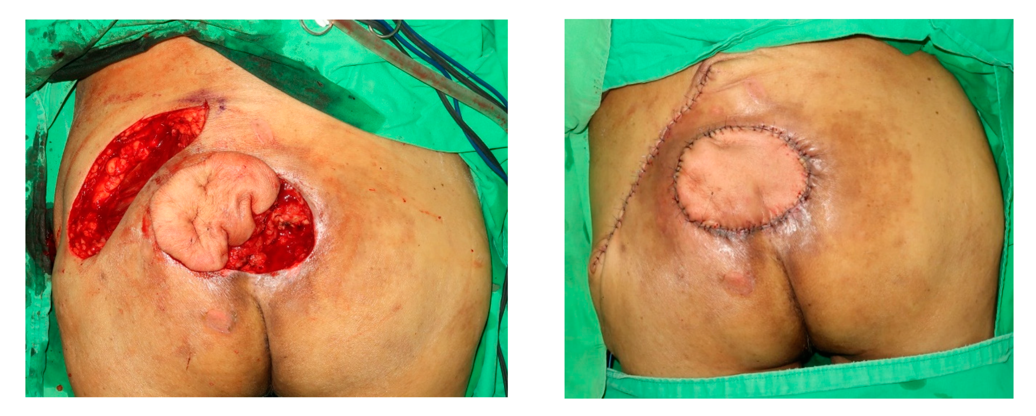 Jpm 12 00132 g004 550