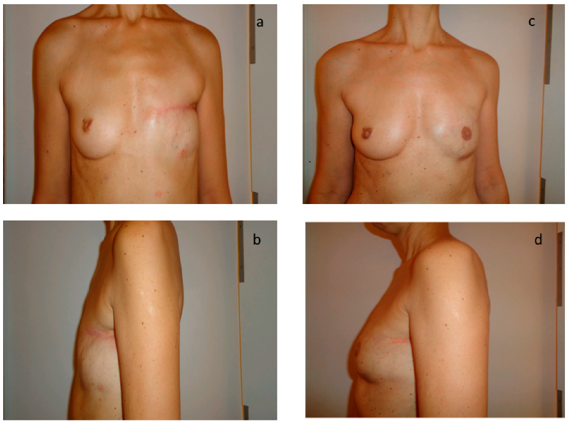 Jpm 12 00153 g001 Jpm 12 00153 g001