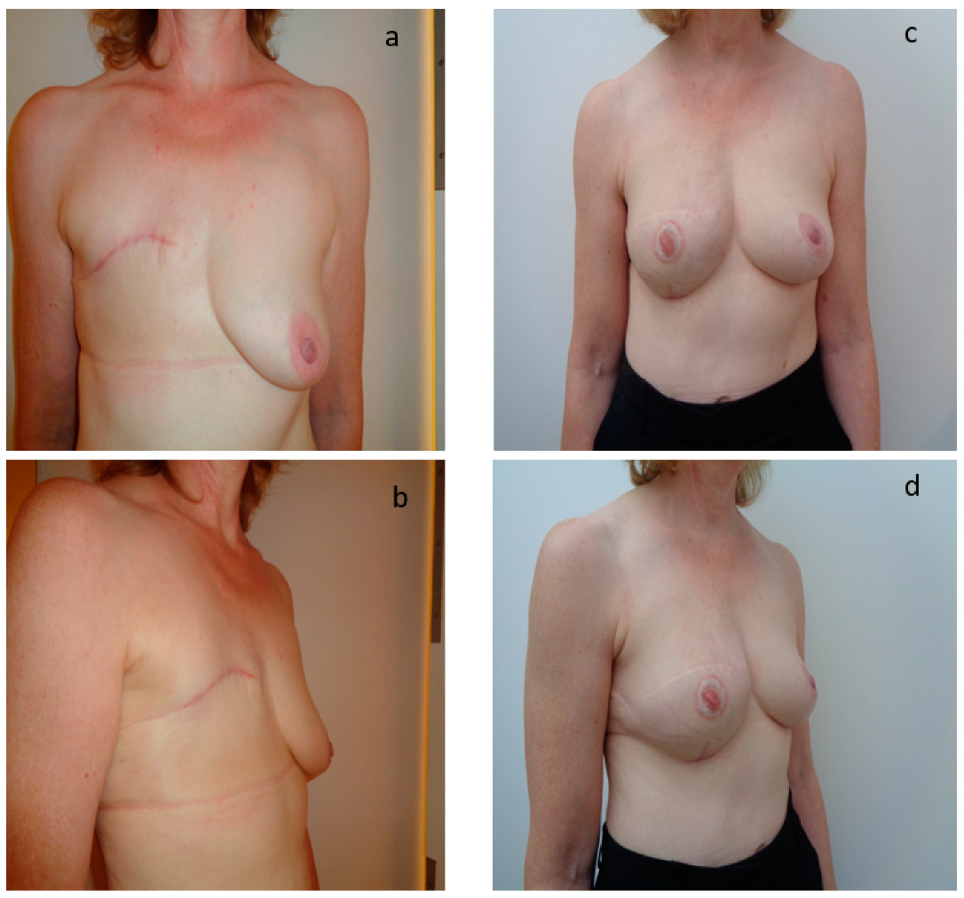 Jpm 12 00153 g003 Jpm 12 00153 g003