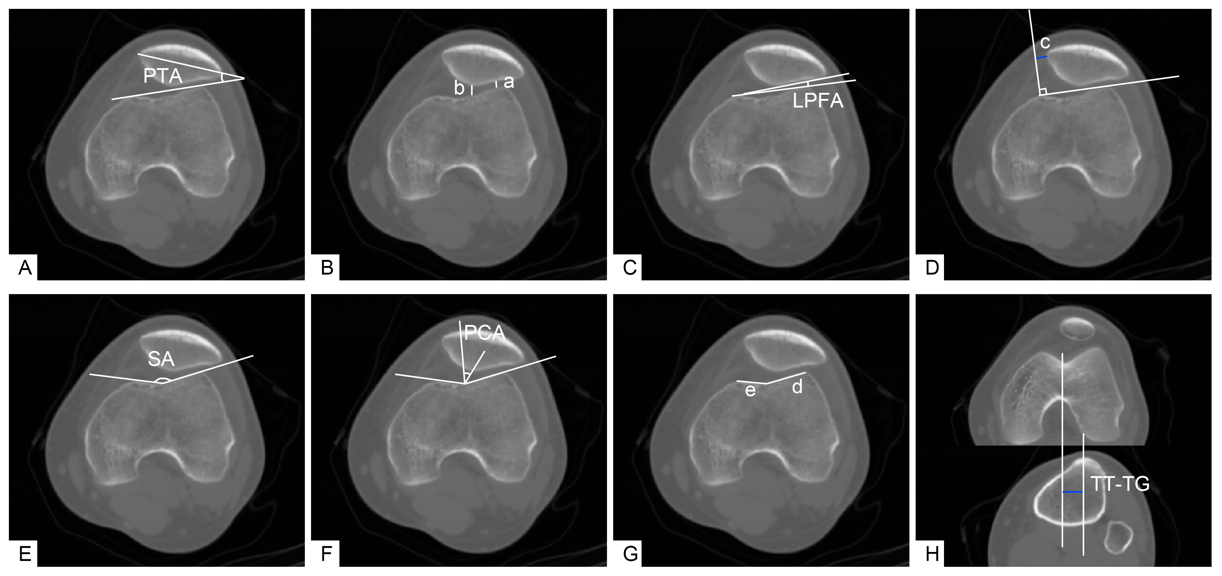 Jpm 12 00242 g002 550